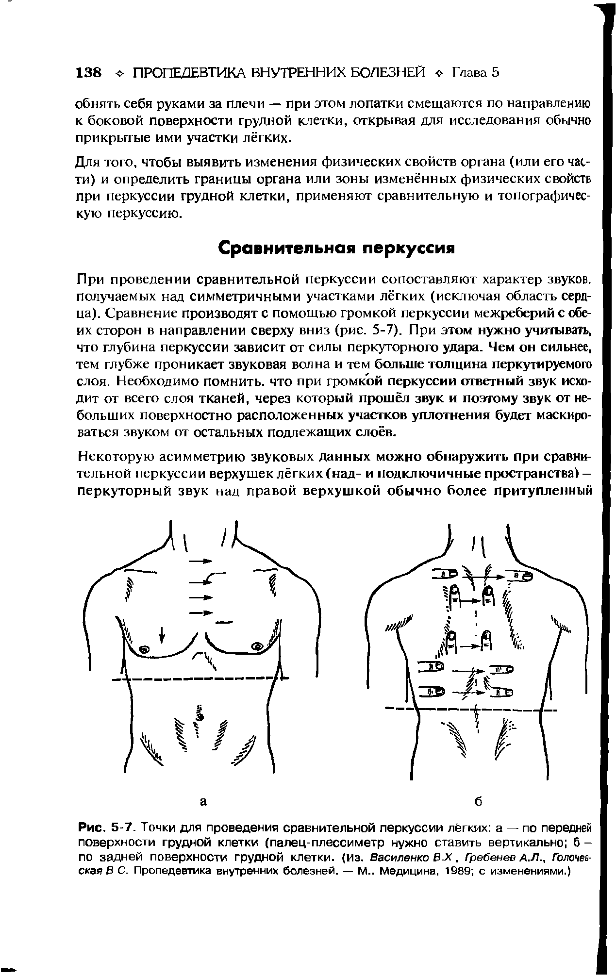 Рис. 5-7. Точки для проведения сравнительной перкуссии лёгких а — по передней поверхности грудной клетки (палец-плессиметр нужно ставить вертикально б -по задней поверхности грудной клетки, (из. Василенко В.X, Гребенев А.Л., Голочев-Ская В С. Пропедевтика внутренних болезней. — М.. Медицина, 1589 с изменениями.)...