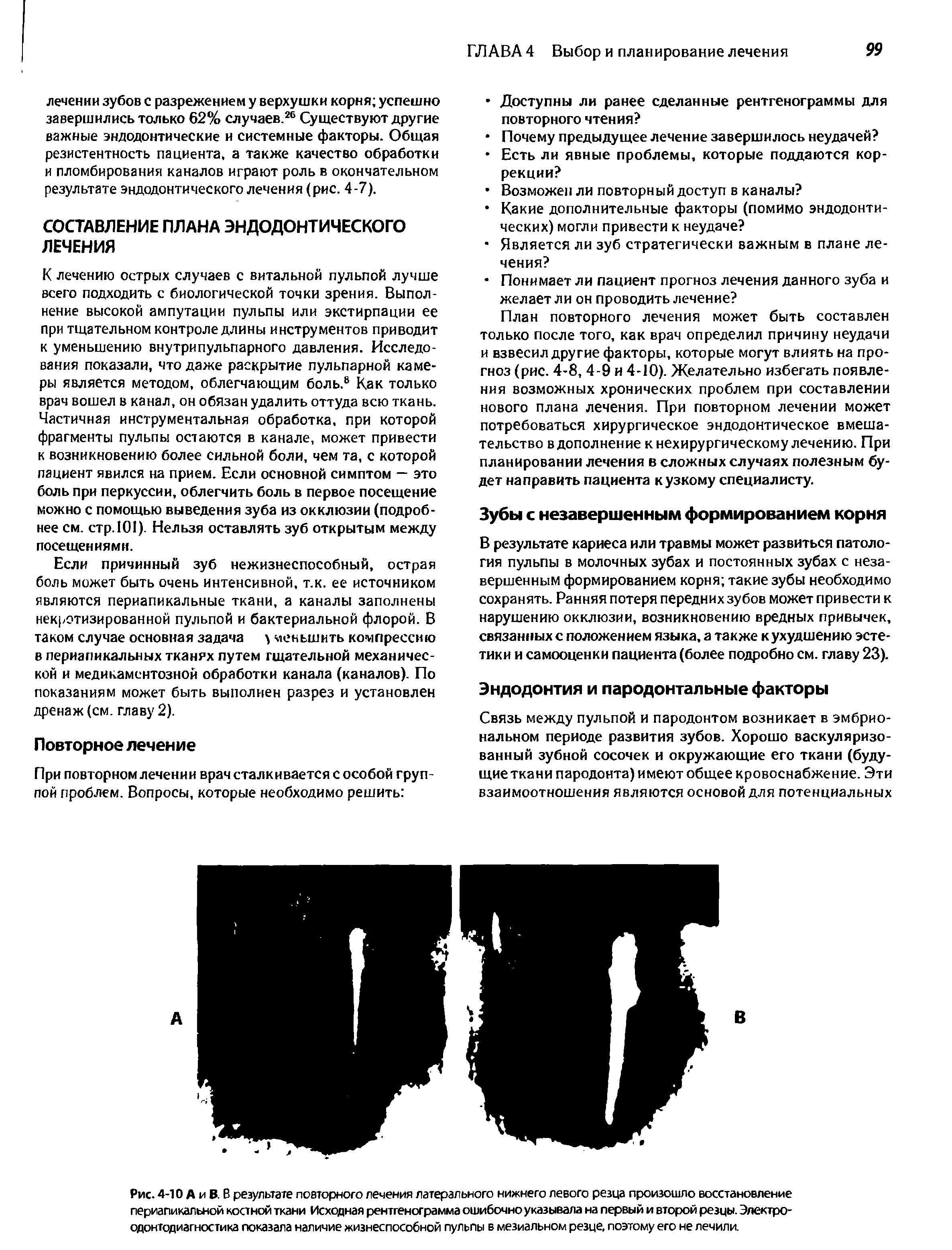 Рис. 4-10 А и В. В результате повторного лечения латерального нижнего левого резца произошло восстановление периапикальной костной ткани Исходная рентгенограмма ошибочно указывала на первый и второй резцы. Электро-одонтодиагностика показала наличие жизнеспособной пульпы в мезиальном резце, поэтому его не лечили.