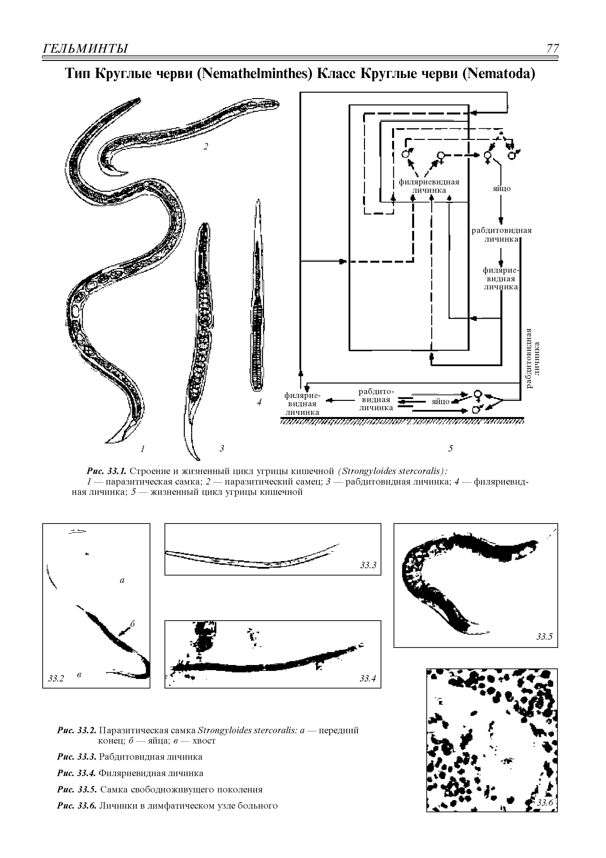 Рис. 33.1. Строение и жизненный цикл угрицы кишечной (S ) ...