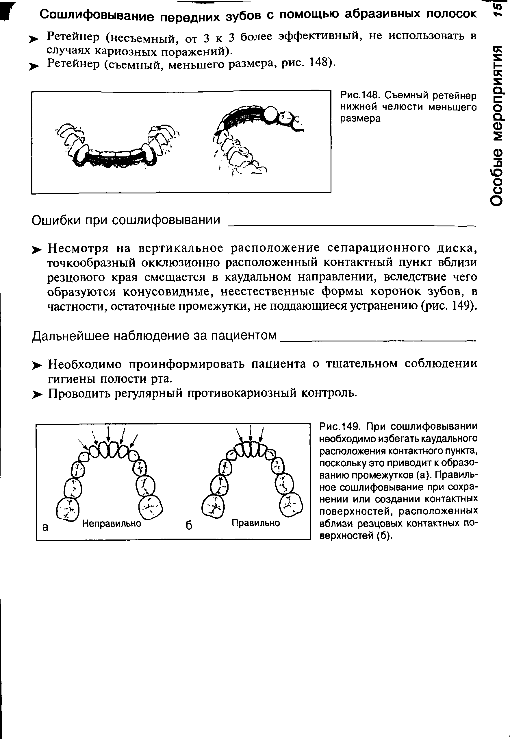 Рис.149. При сошлифовывании необходимо избегать каудального расположения контактного пункта, поскольку это приводит к образованию промежутков (а). Правильное сошлифовывание при сохранении или создании контактных поверхностей, расположенных вблизи резцовых контактных поверхностей (б).