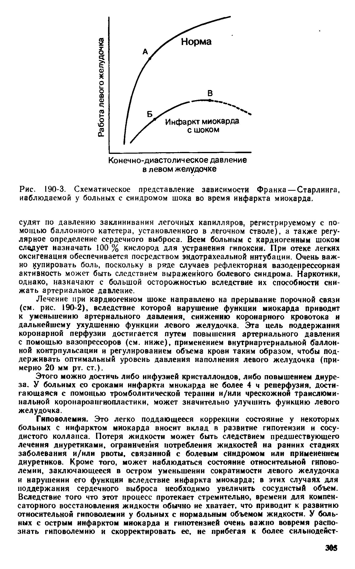 Рис. 190-3. Схематическое представление зависимости Франка — Старлинга, наблюдаемой у больных с синдромом шока во время инфаркта миокарда.