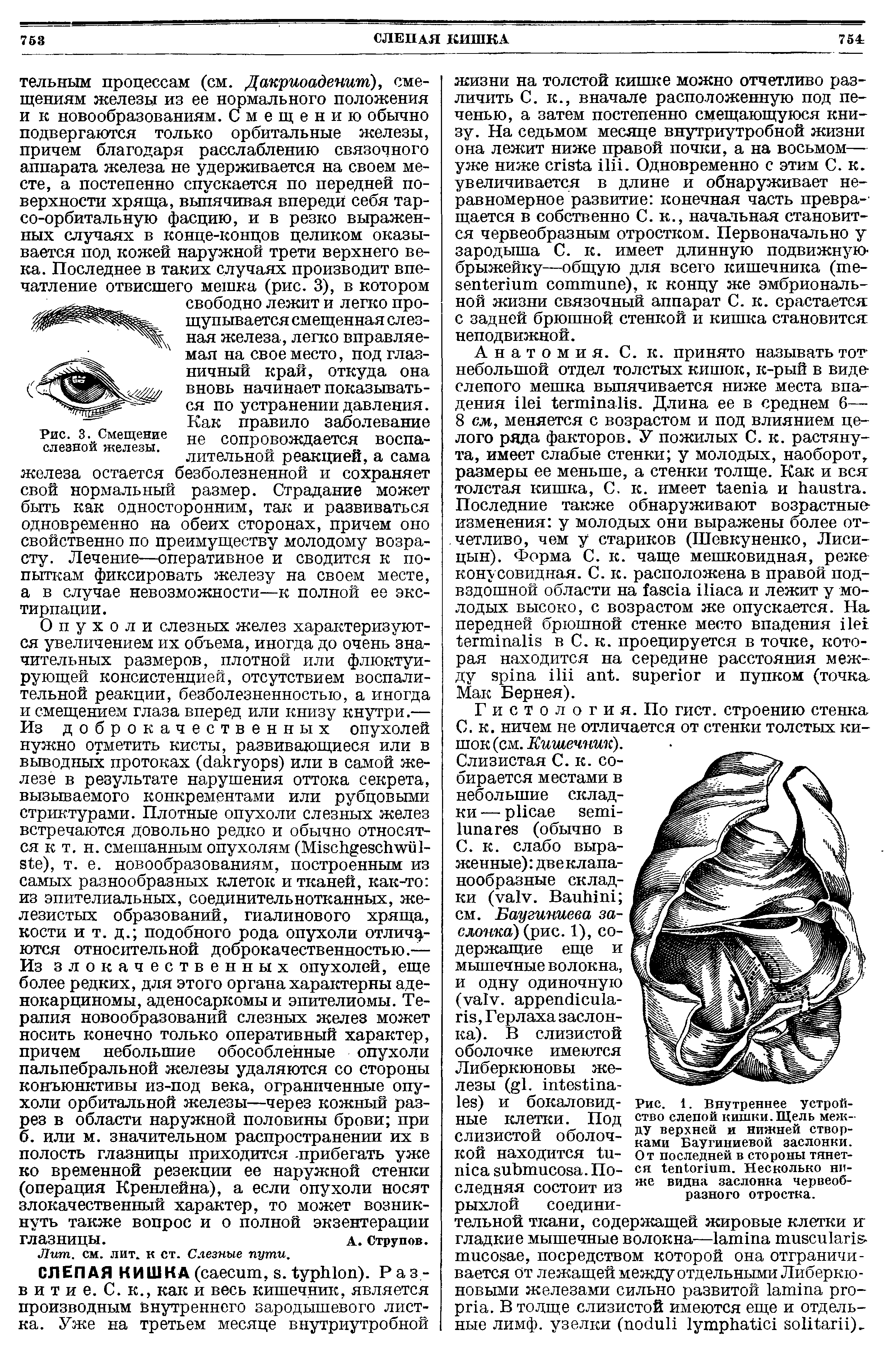 Рис. 1. Внутреннее устройство слепой кишки. Щель между верхней и нижней створками Баугиниевой заслонки. От последней в стороны тянется . Несколько ниже видна заслонка червеобразного отростка.