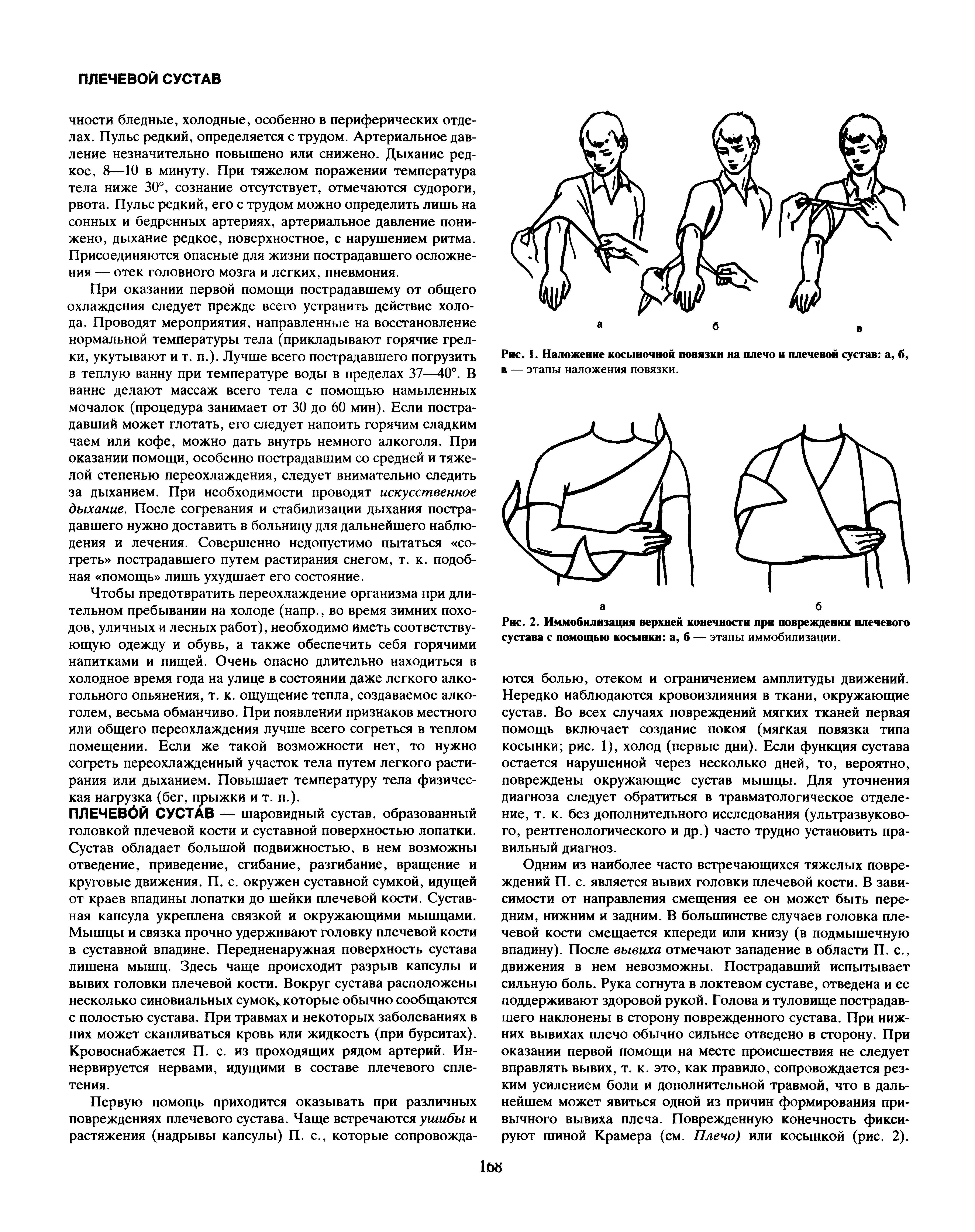 Рис. 1. Наложение косыночной повязки на плечо и плечевой сустав а, б, в — этапы наложения повязки.