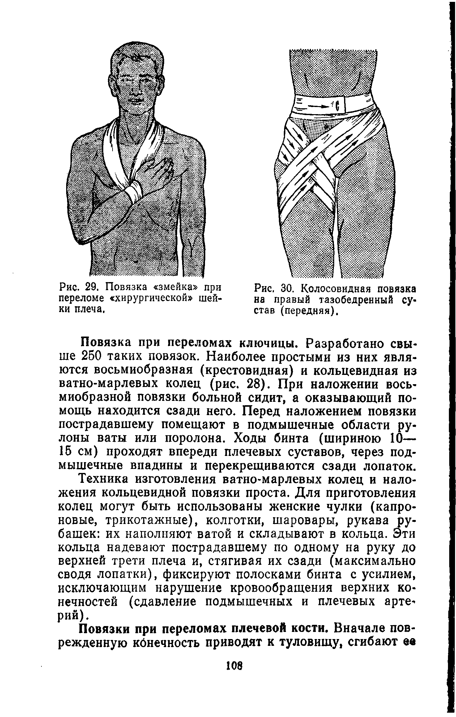 Рис. 30. Колосовидная повязка на правый тазобедренный сустав (передняя).