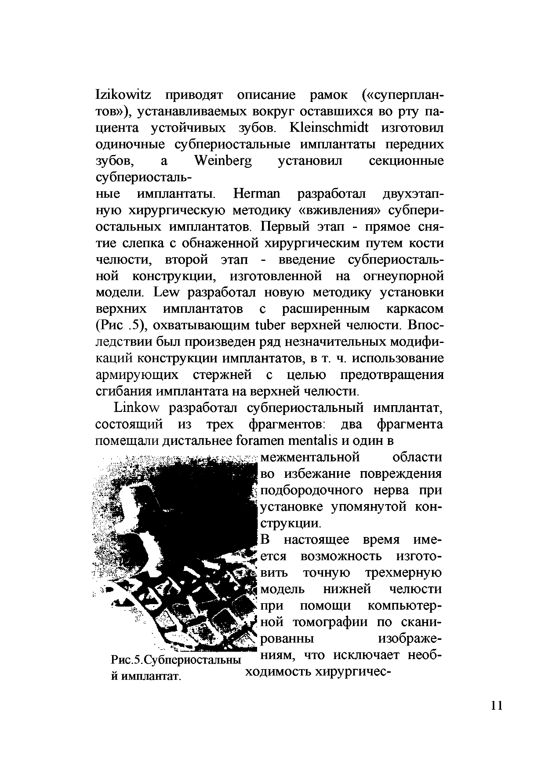 Рис.5.Субпериостальны ниям, что исключает необ-й имплантат. ходимость хирургичес-...