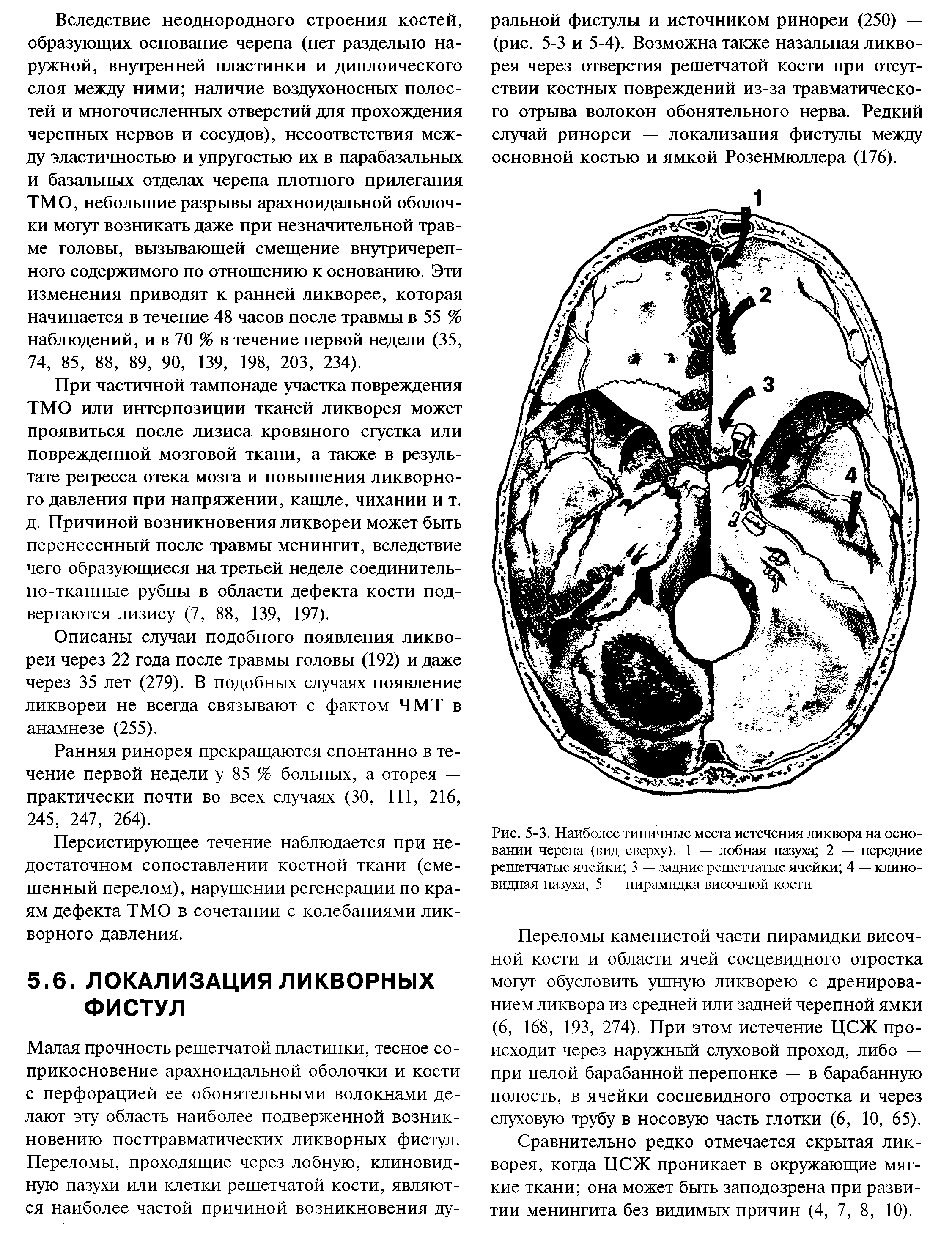 Рис. 5-3. Наиболее типичные места истечения ликвора на основании черепа (вид сверху). 1 — лобная пазуха 2 — передние решетчатые ячейки 3 — задние решетчатые ячейки 4 — клиновидная пазуха 5 — пирамидка височной кости...