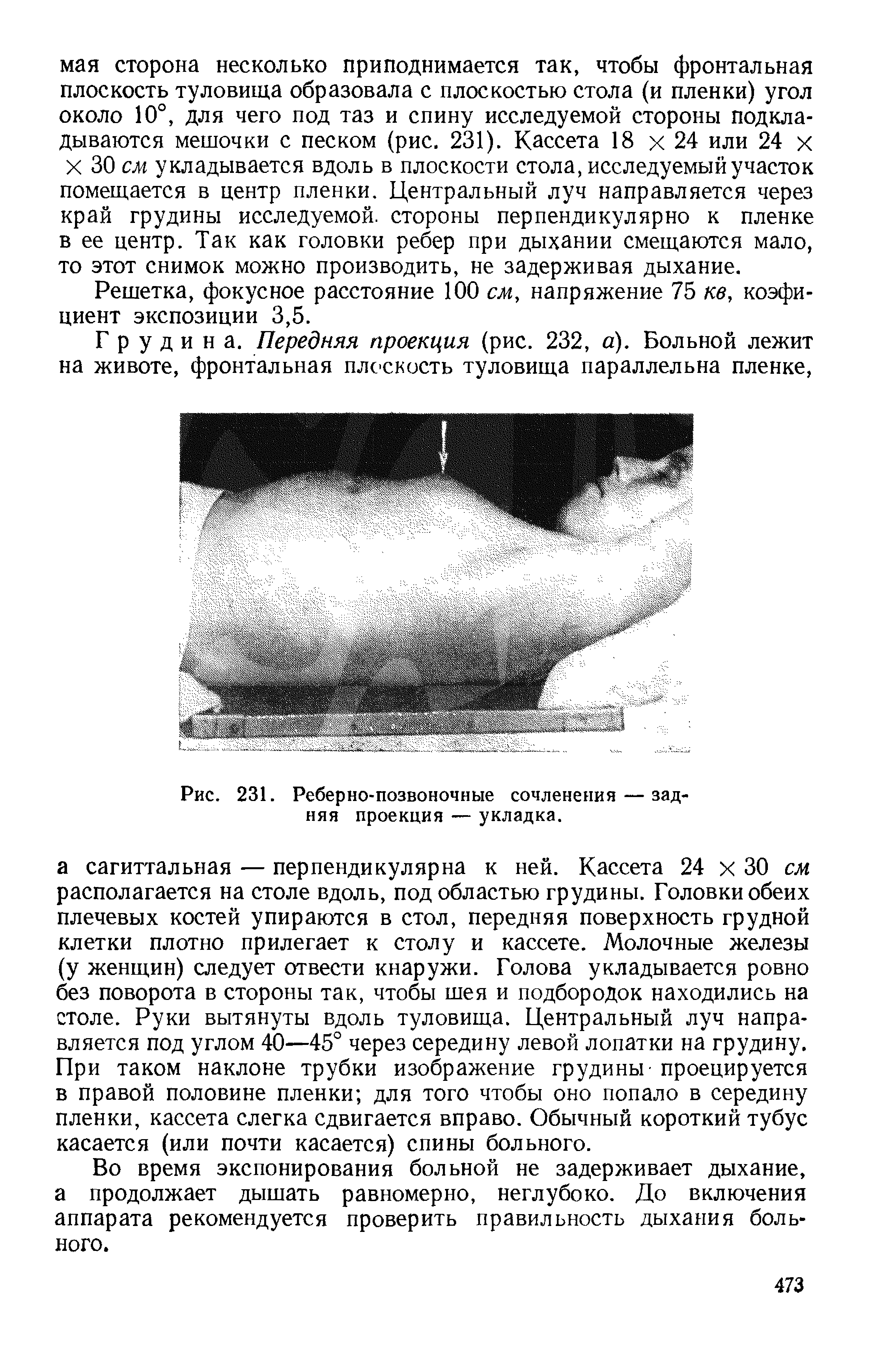 Рис. 231. Реберно-позвоночные сочленения — задняя проекция — укладка.