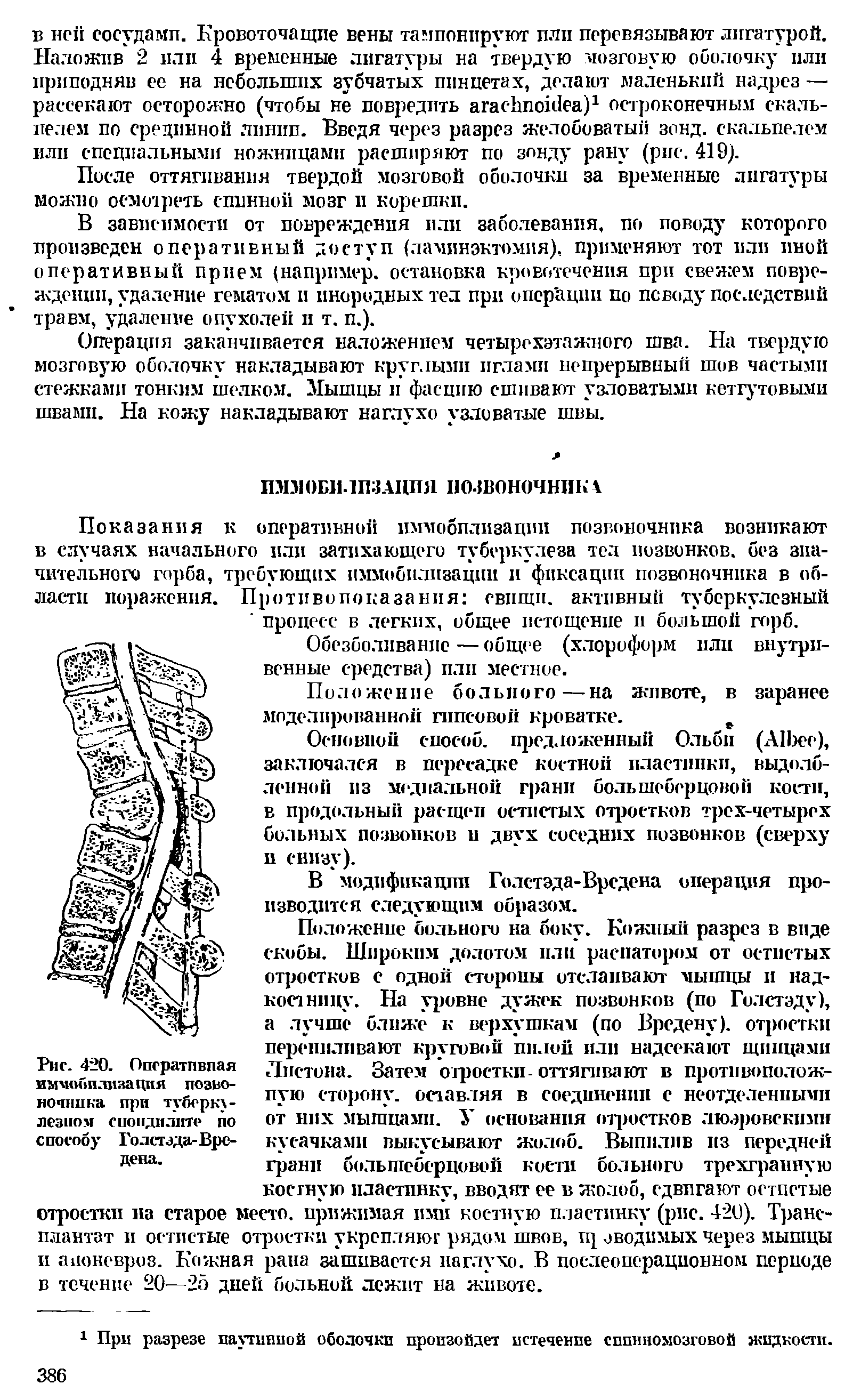 Рис. 420. Оперативная иммобилизация позвоночника при туберкулезном сиондилите по способу Голстэда-Врс-дена.