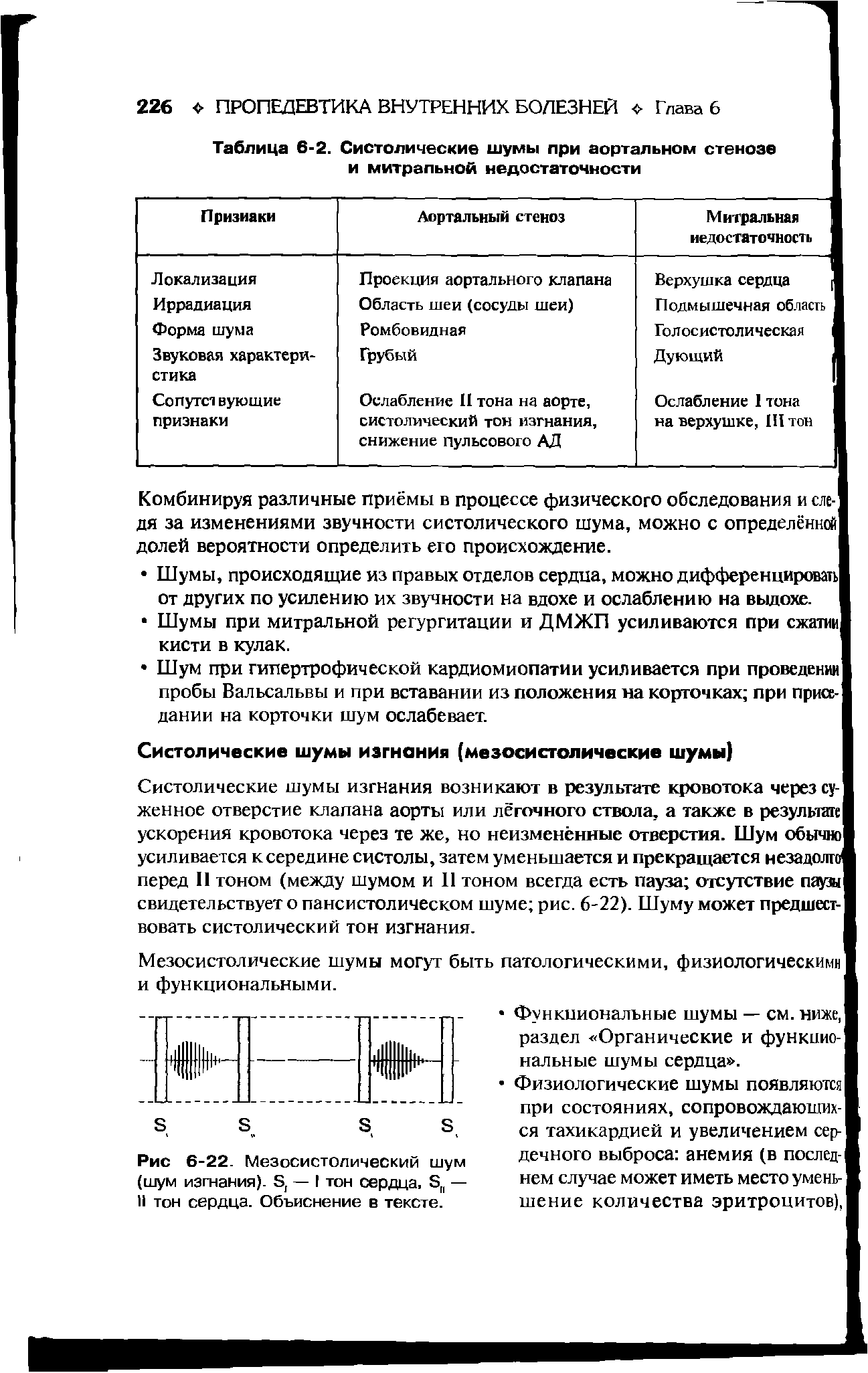 Таблица 6-2. Систолические шумы при аортальном стенозе и митральной недостаточности...