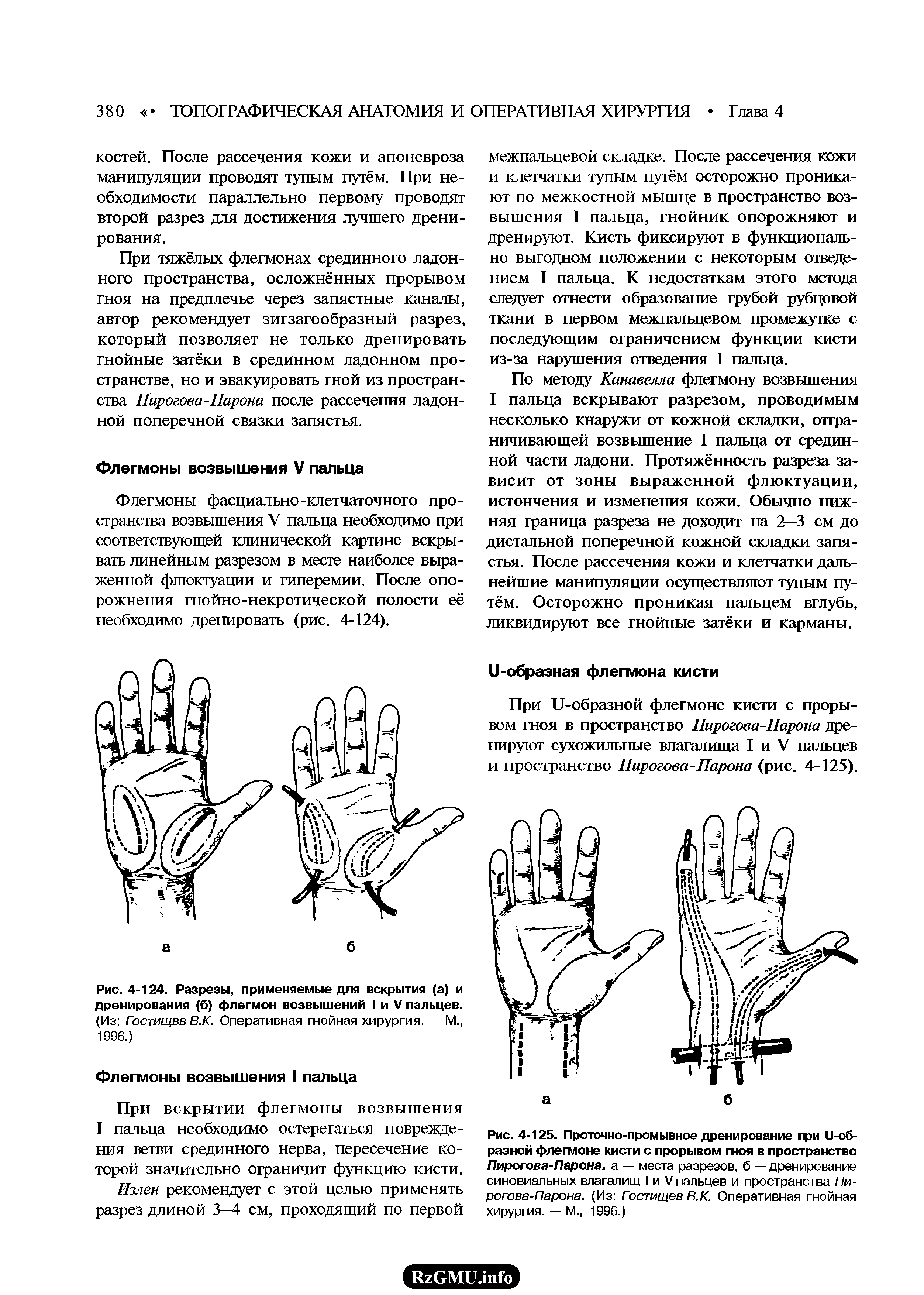 Рис. 4-124. Разрезы, применяемые для вскрытия (а) и дренирования (б) флегмон возвышений I и V пальцев. (Из Гостищвв В.К. Оперативная гнойная хирургия. — М., 1996.)...