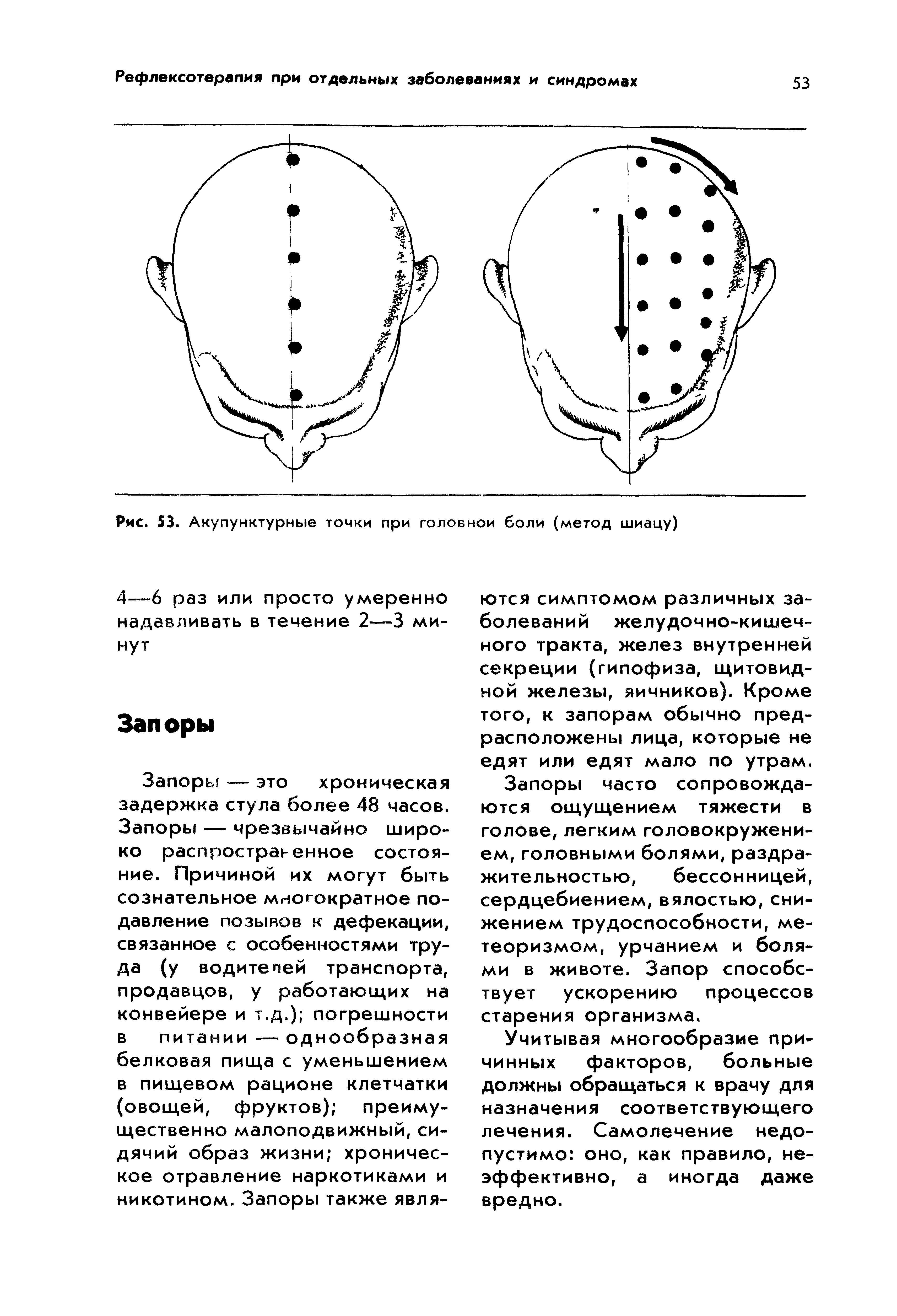 Рис. 53. Акупунктурные точки при головной боли (метод шиацу)...