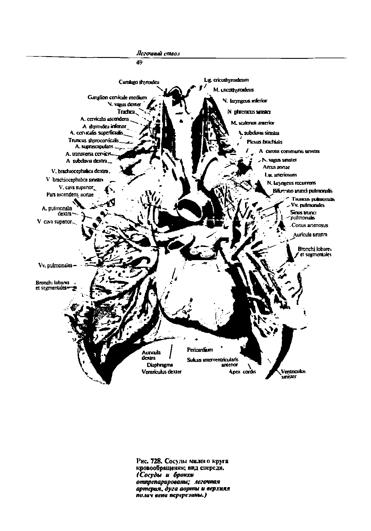 Рис. 728. Сосуды малого круга кровообращения вид спереди. (Сосуды и бронхи отпрепарированы легочная артерия, дуга аорты а верхняя палач вена перерезаны.)...