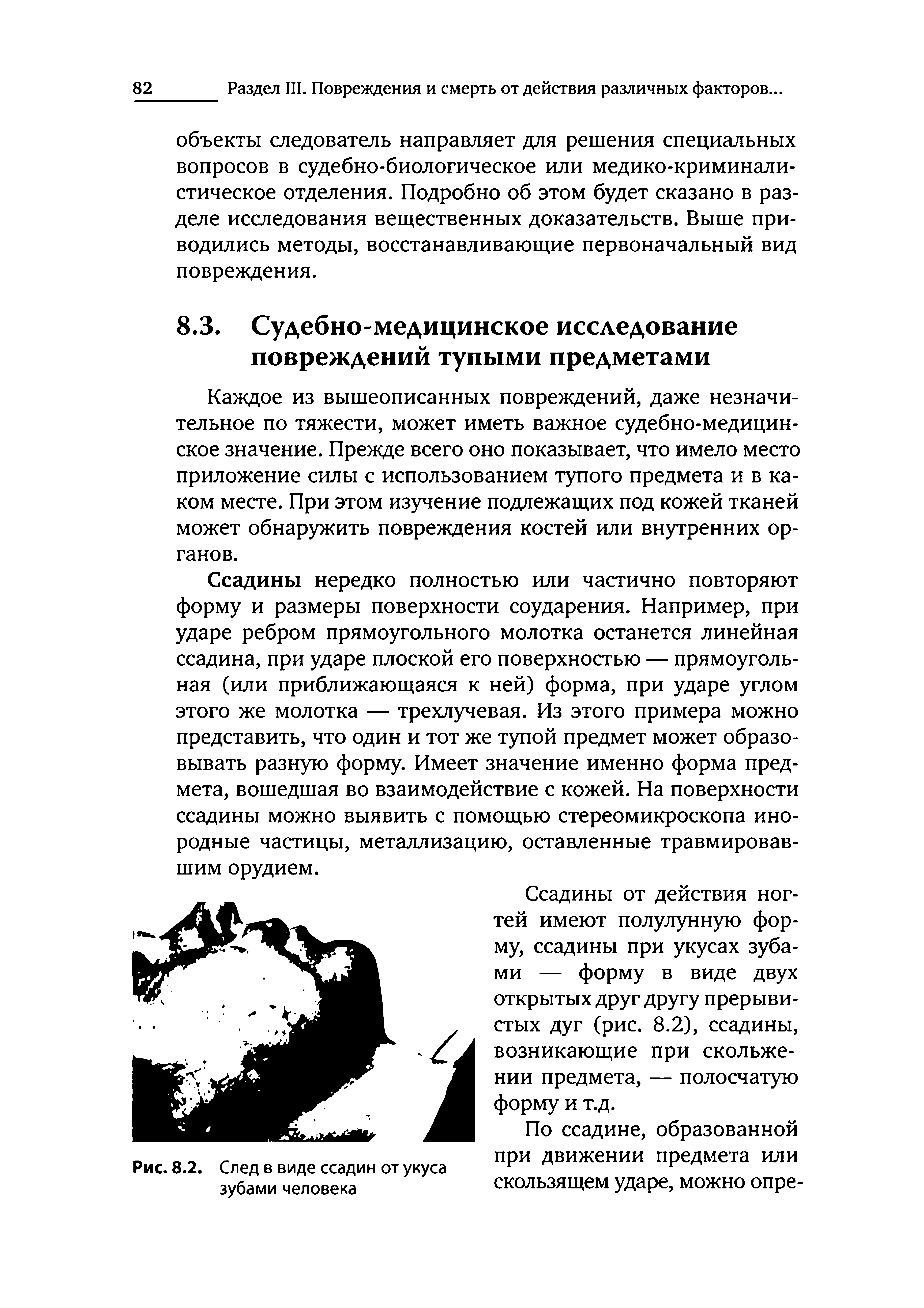 Рис. 8.2. След в виде ссадин от укуса зубами человека...