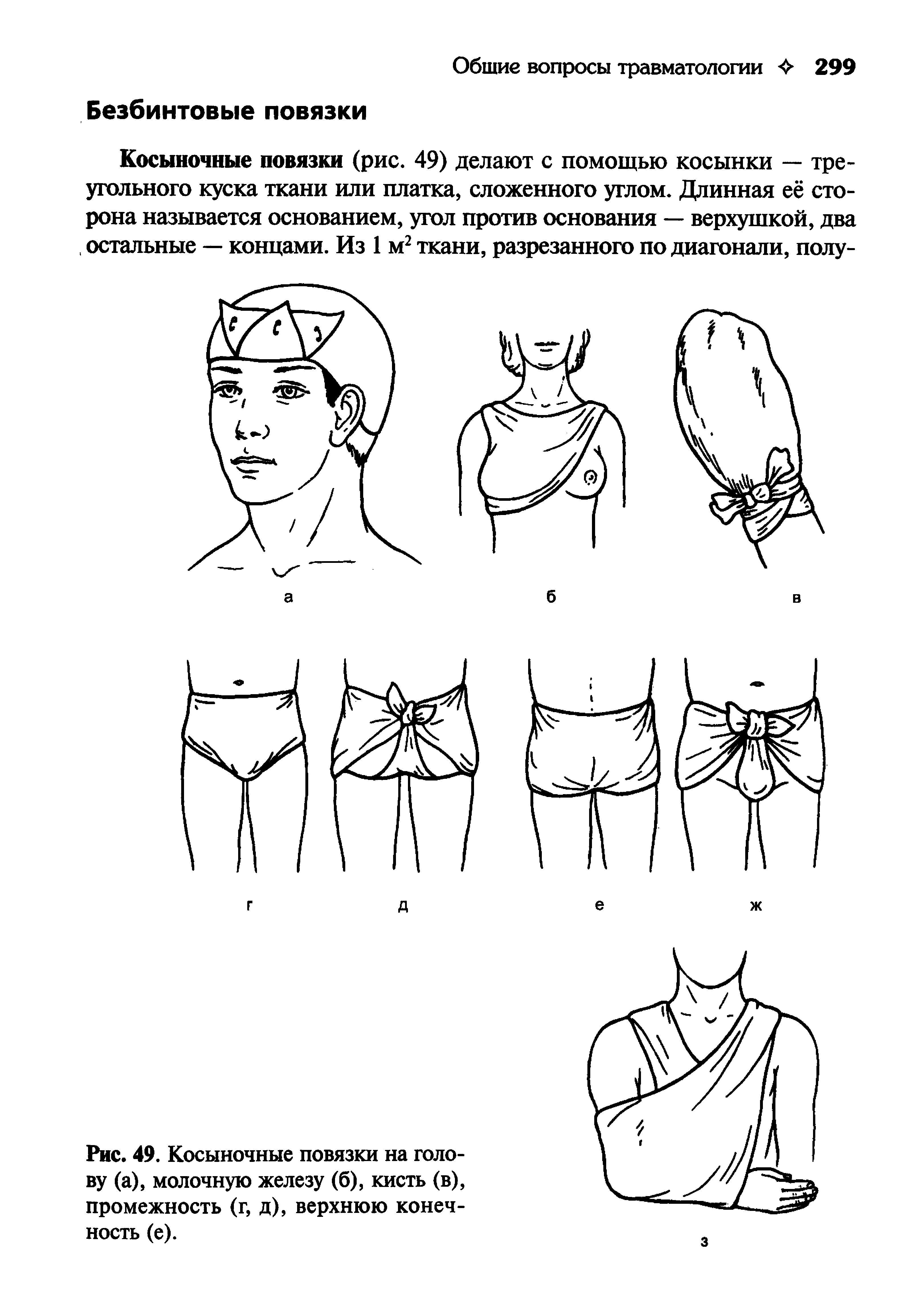 Рис. 49. Косыночные повязки на голову (а), молочную железу (б), кисть (в), промежность (г, д), верхнюю конечность (е).