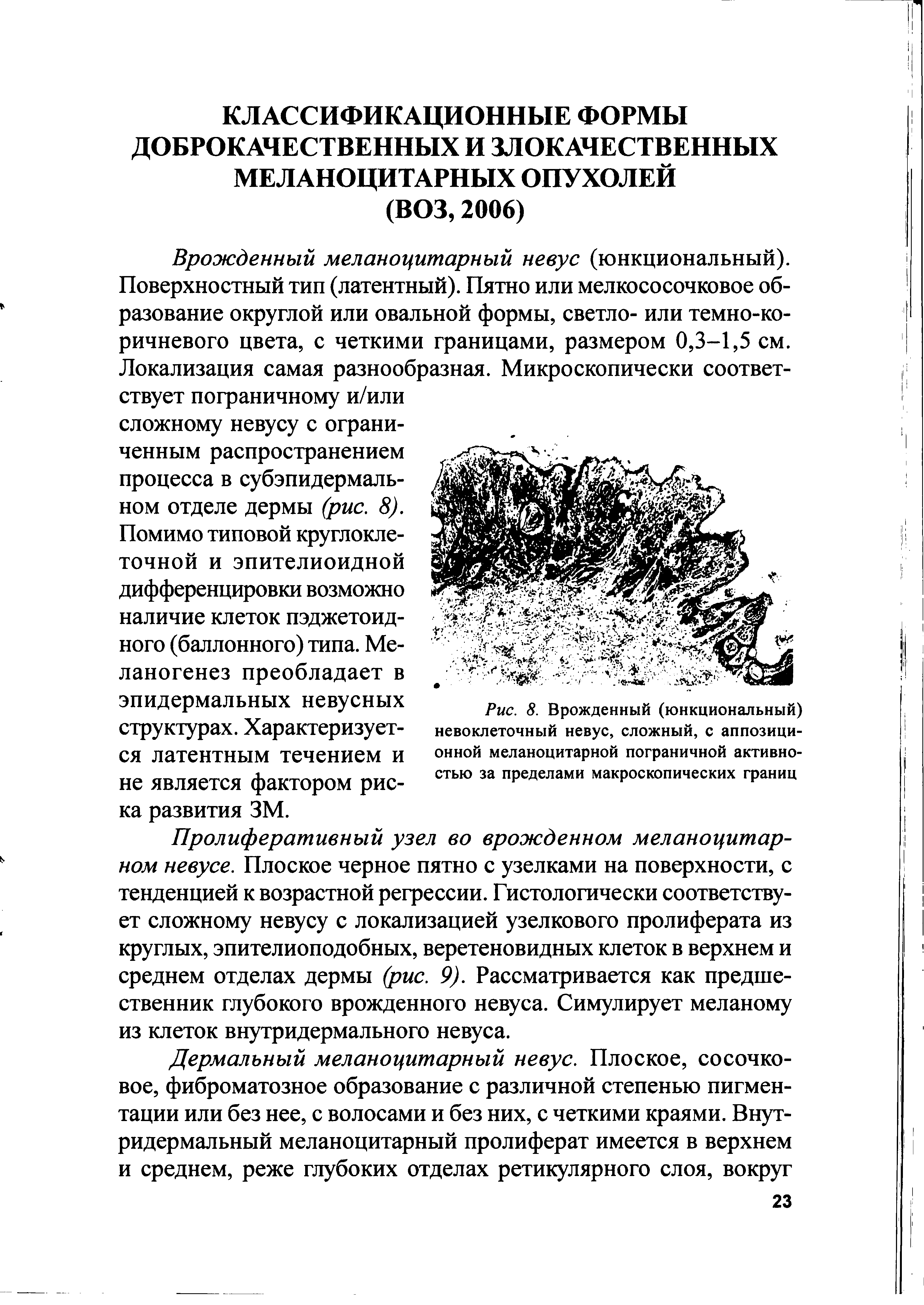 Рис. 8. Врожденный (юнкциональный) невоклеточный невус, сложный, с аппозиционной меланоцитарной пограничной активностью за пределами макроскопических границ...