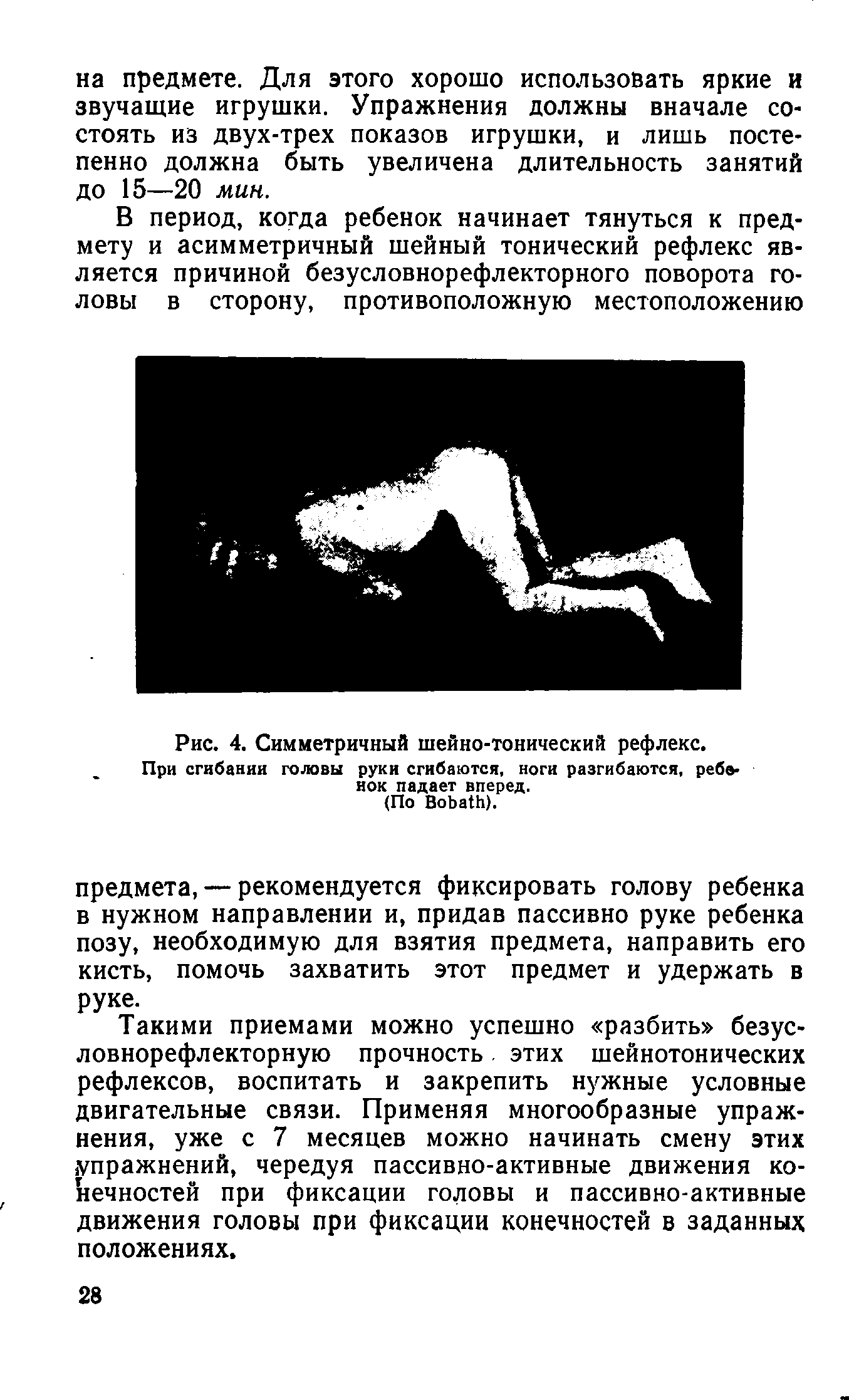 Рис. 4. Симметричный шейно-тонический рефлекс. При сгибании головы руки сгибаются, ноги разгибаются, ребенок падает вперед.