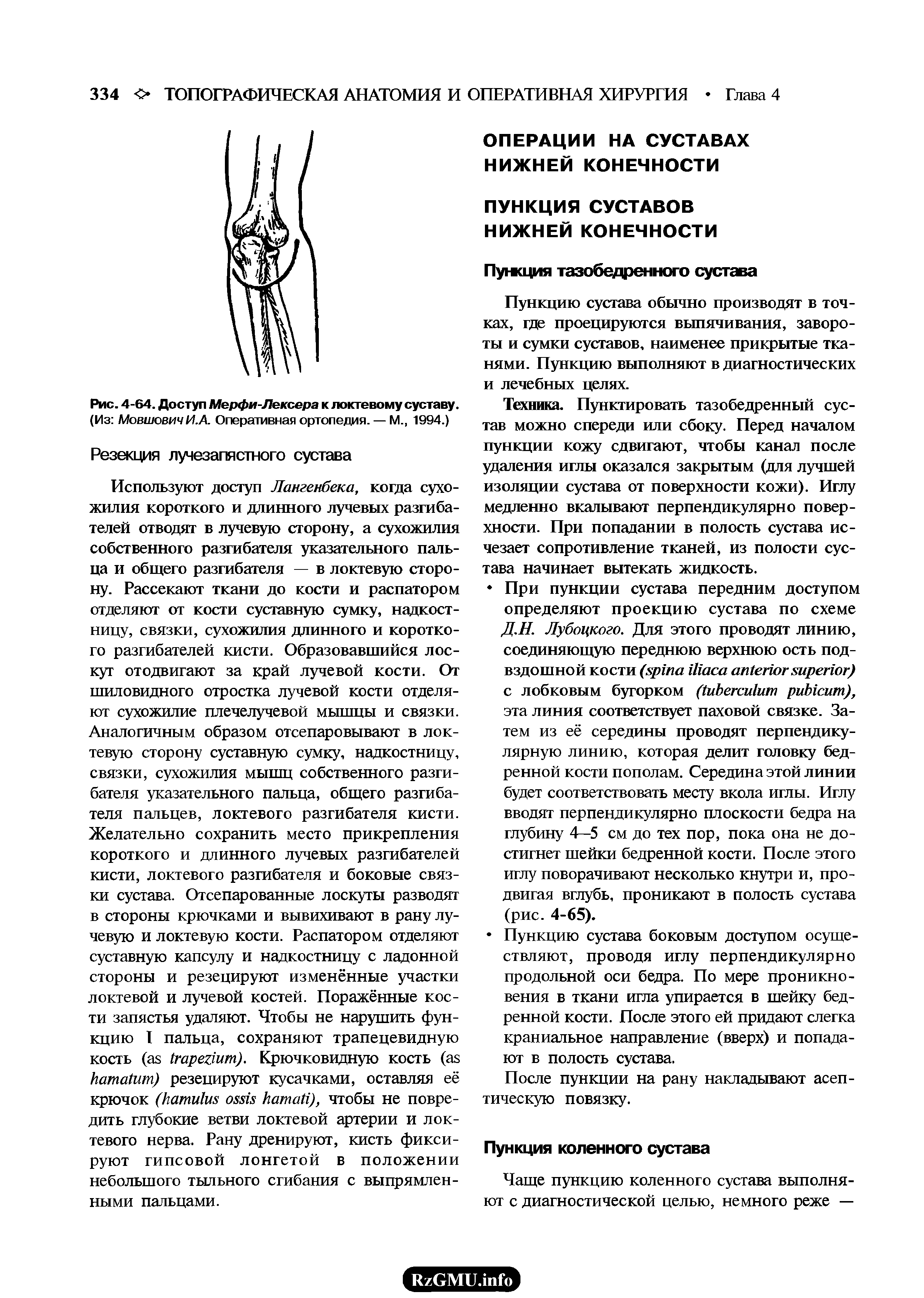 Рис. 4-64. Доступ Мерфи-Лексера к локтевому суставу. (Из Мовшович И.А. Оперативная ортопедия. — М., 1994.)...