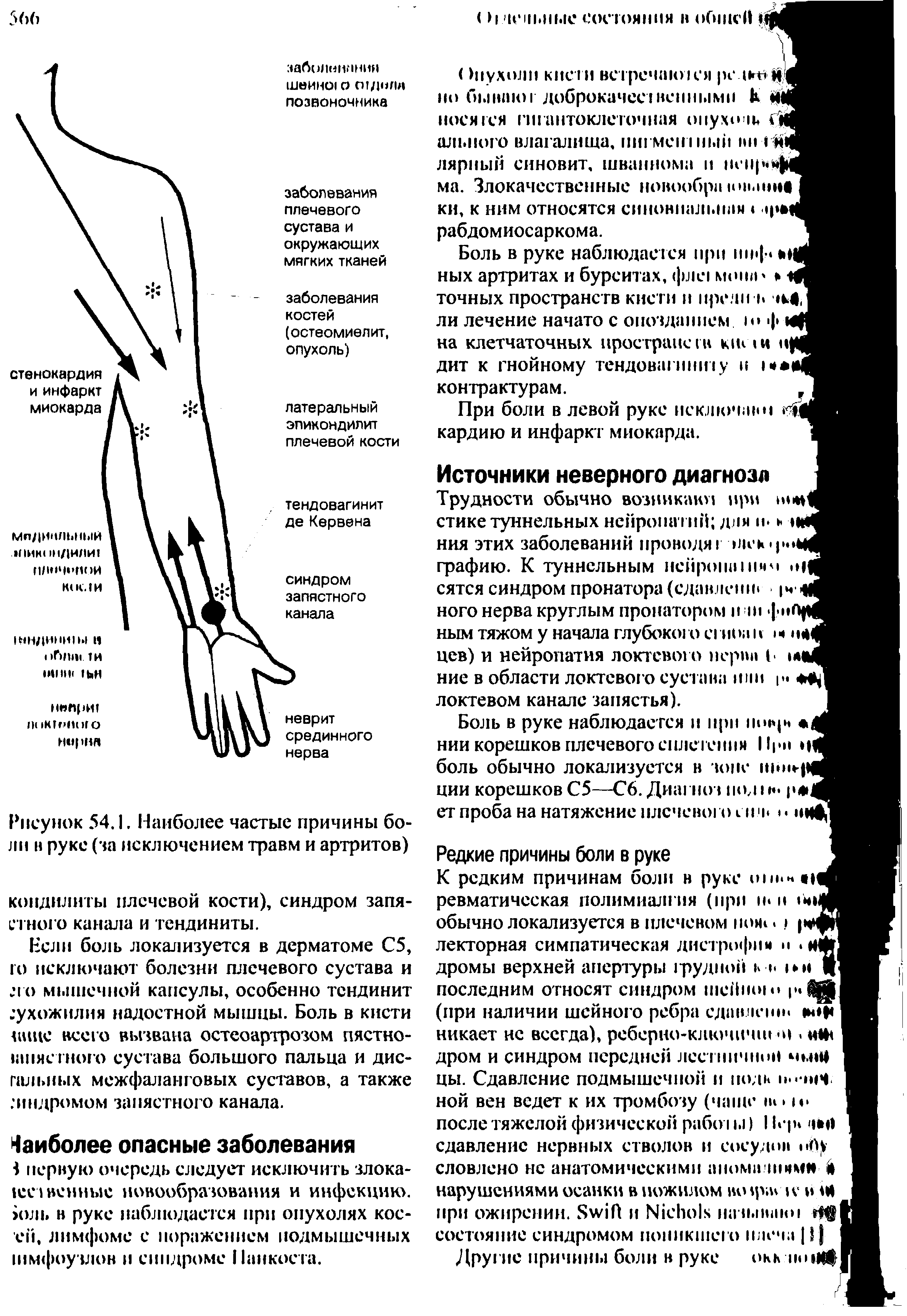 Рисунок 54.1. Наиболее частые причины боли в руке (за исключением травм и артритов) кондилиты плечевой кости), синдром запястного канала и тендиниты.