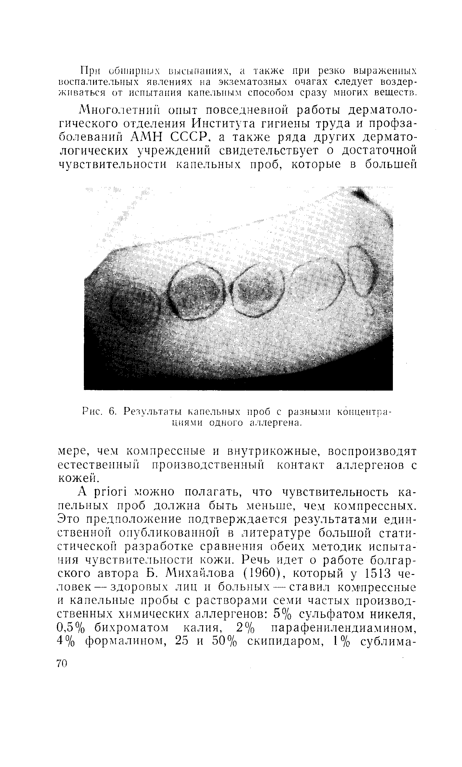 Рис. 6. Результаты капельных проб с разными концентрациями одного аллергена.