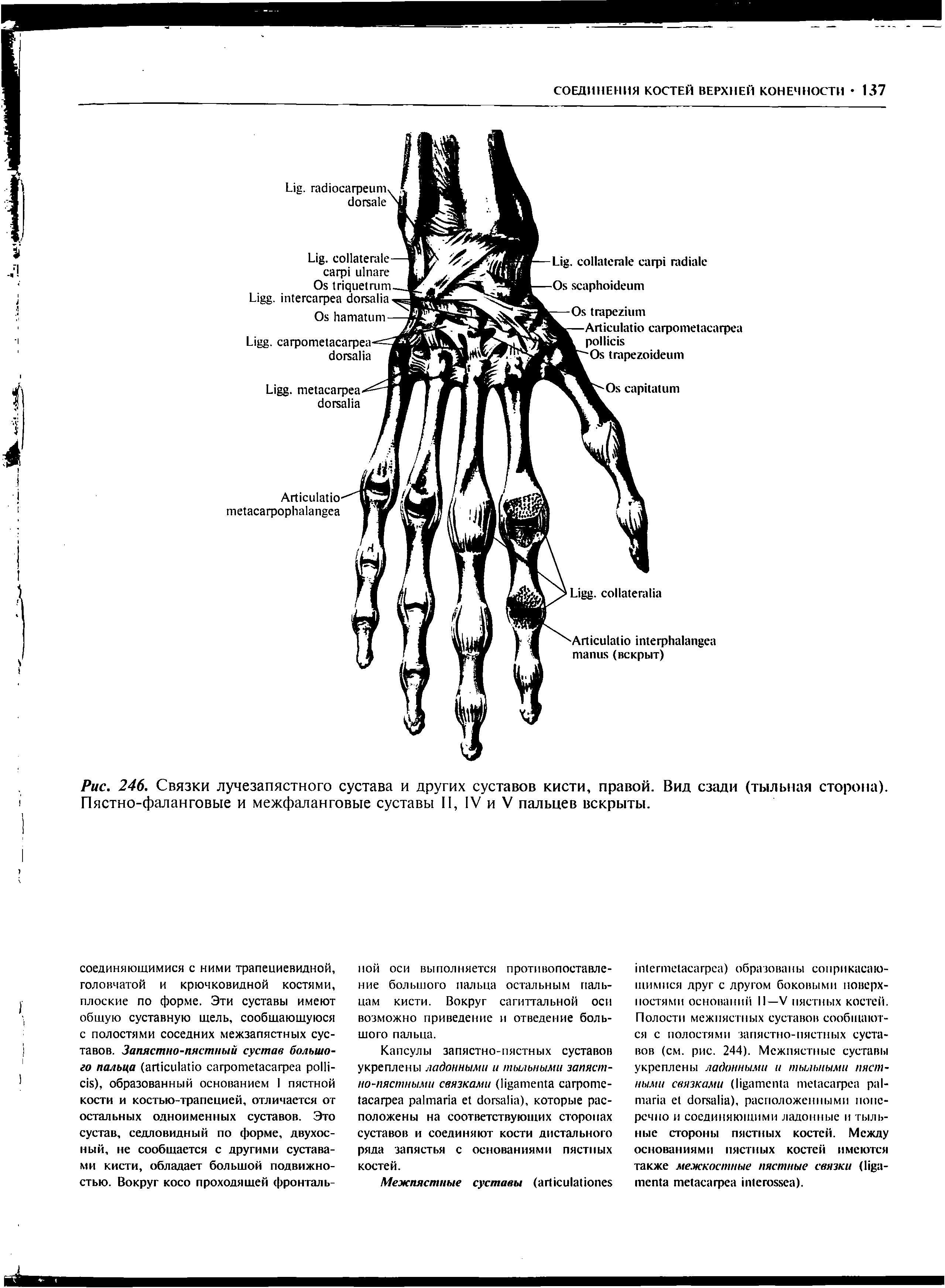 Рис. 246. Связки лучезапястного сустава и других суставов кисти, правой. Вид сзади (тыльная сторона). Пястно-фаланговые и межфаланговые суставы II, IV и V пальцев вскрыты.