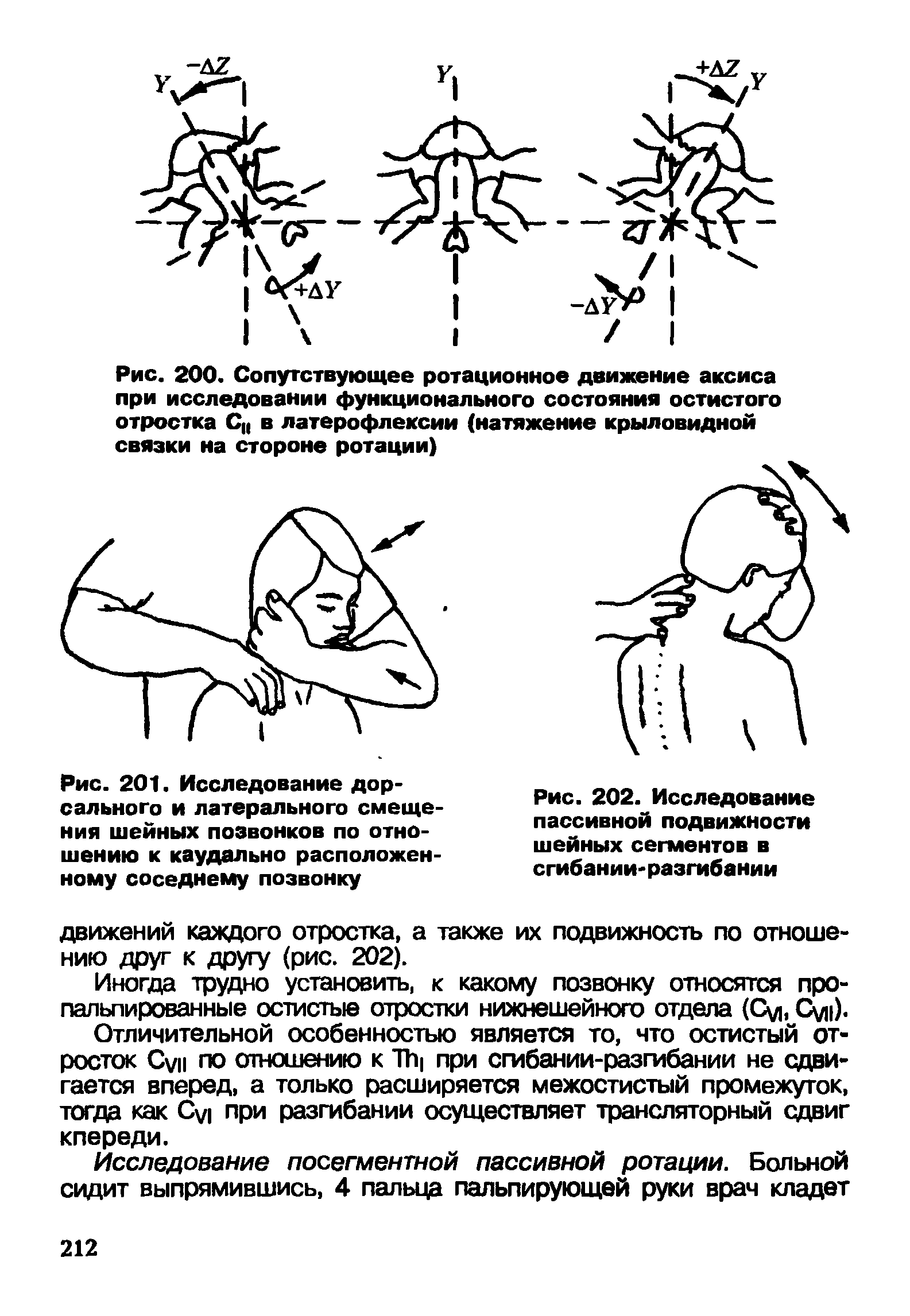 Рис. 201. Исследование дорсального и латерального смещения шейных позвонков по отношению к каудально расположенному соседнему позвонку...