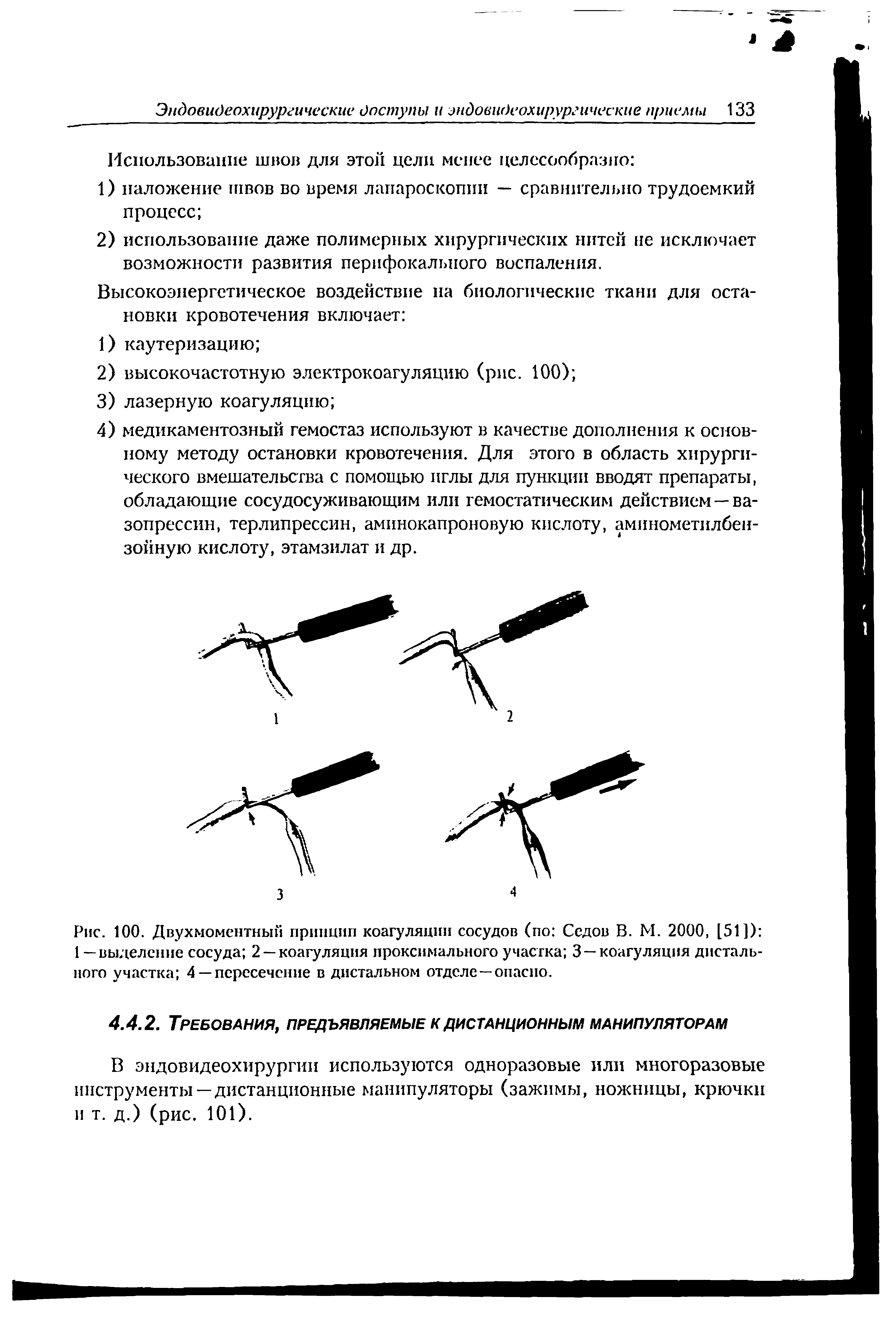 Рис. 100. Двухмоментный принцип коагуляции сосудов (по Седов В. М. 2000, [51]) 1— выделение сосуда 2 —коагуляция проксимального участка 3 —коагуляция дистального участка 4 — пересечение в дистальном отделе —опасно.