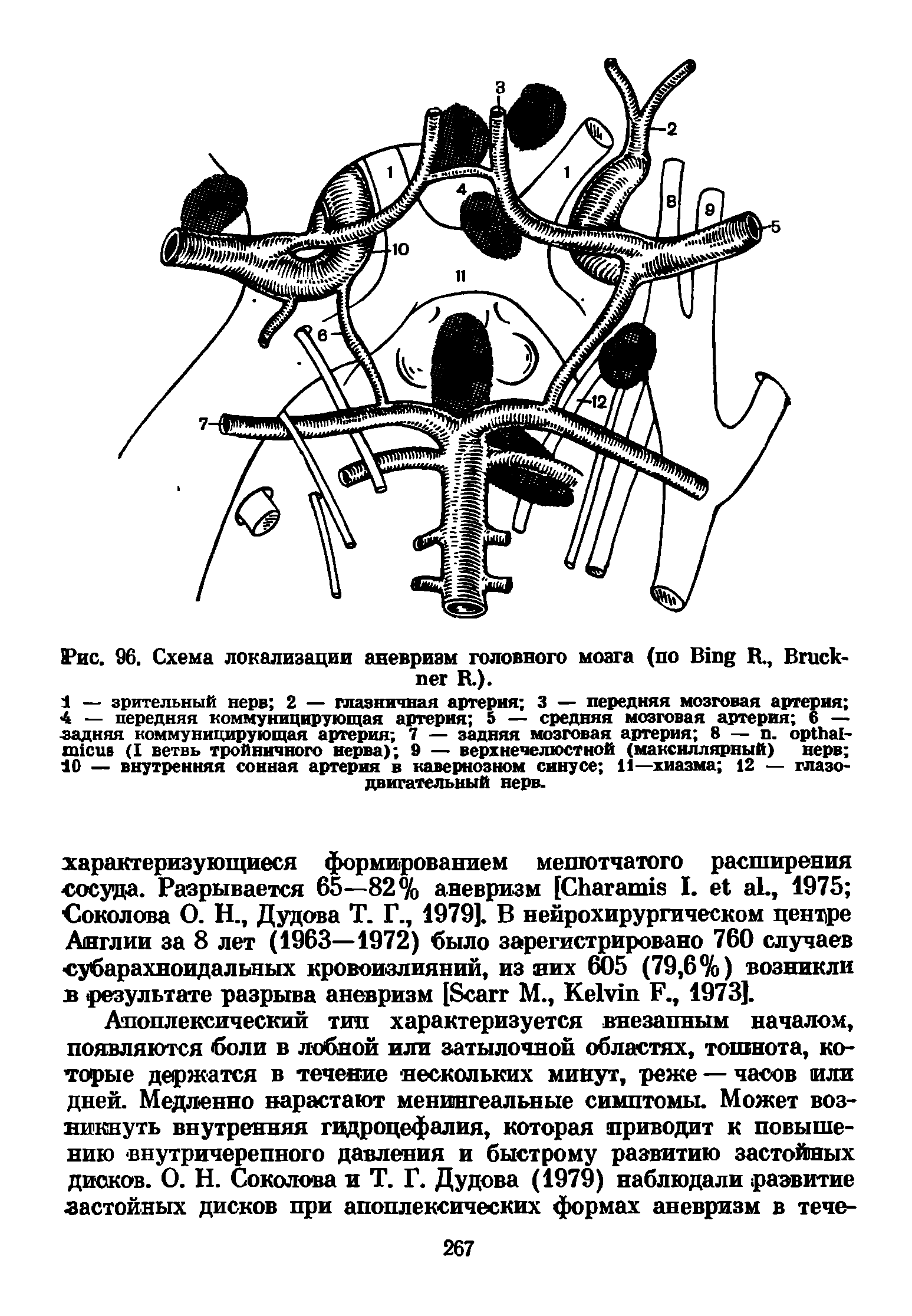 Рис. 96. Схема локализации аневризм головного мозга (по B R., B R.).