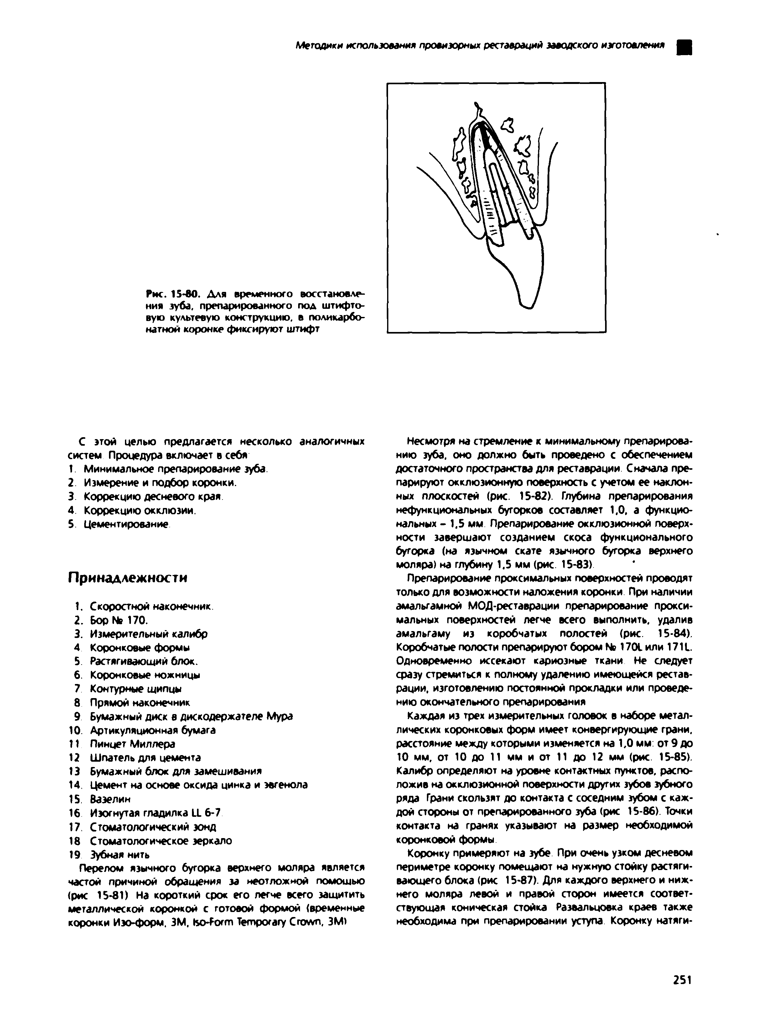 Рис. 15-80. Для временного восстановления зуба, препарированного под штифтовую культевую конструкцию, в поликарбо-натной коронке фиксируют штифт...