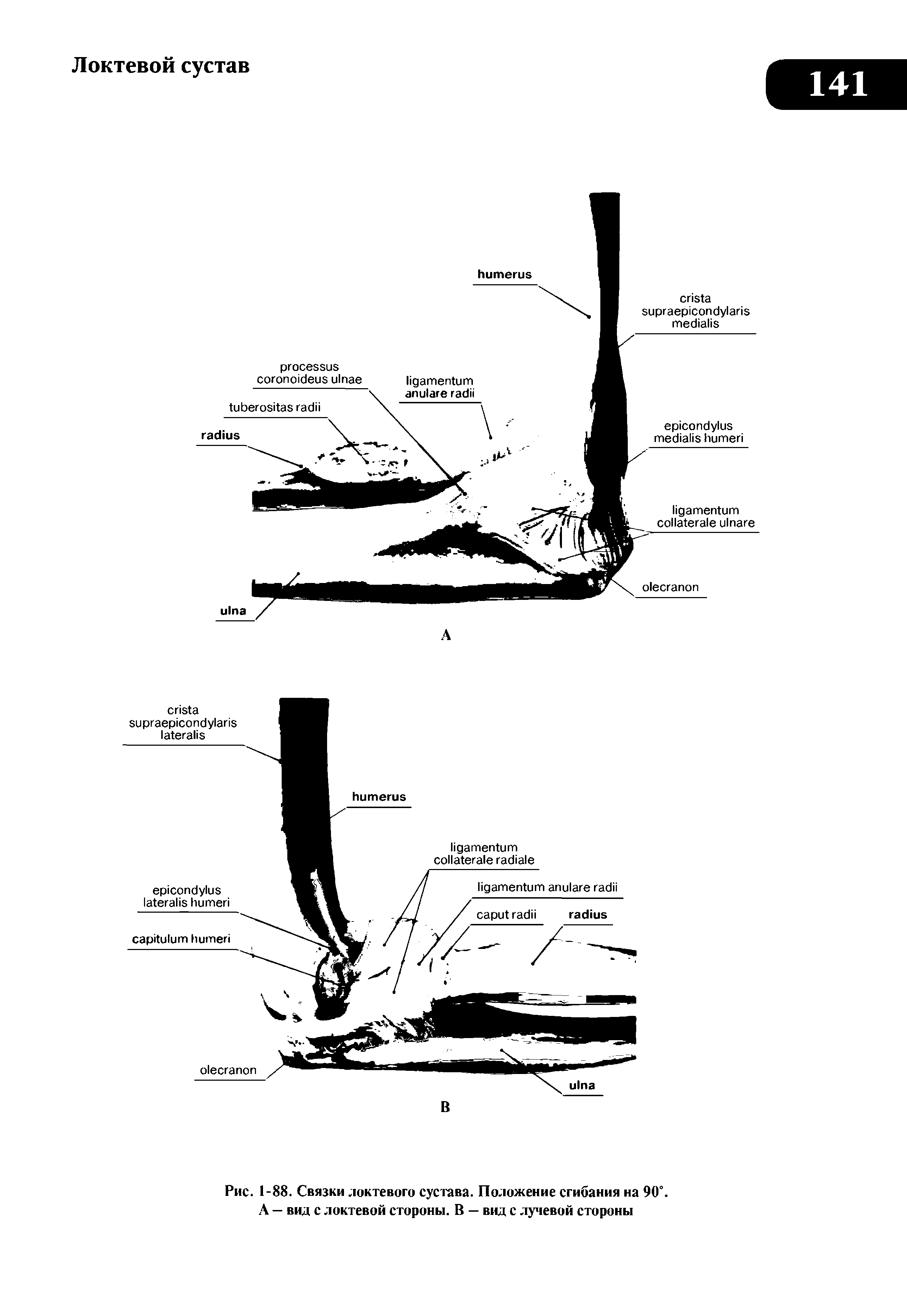 Рис. 1-88. Связки локтевого сустава. Положение сгибания на 90°. А — вид с локтевой стороны. В — вид с лучевой стороны...