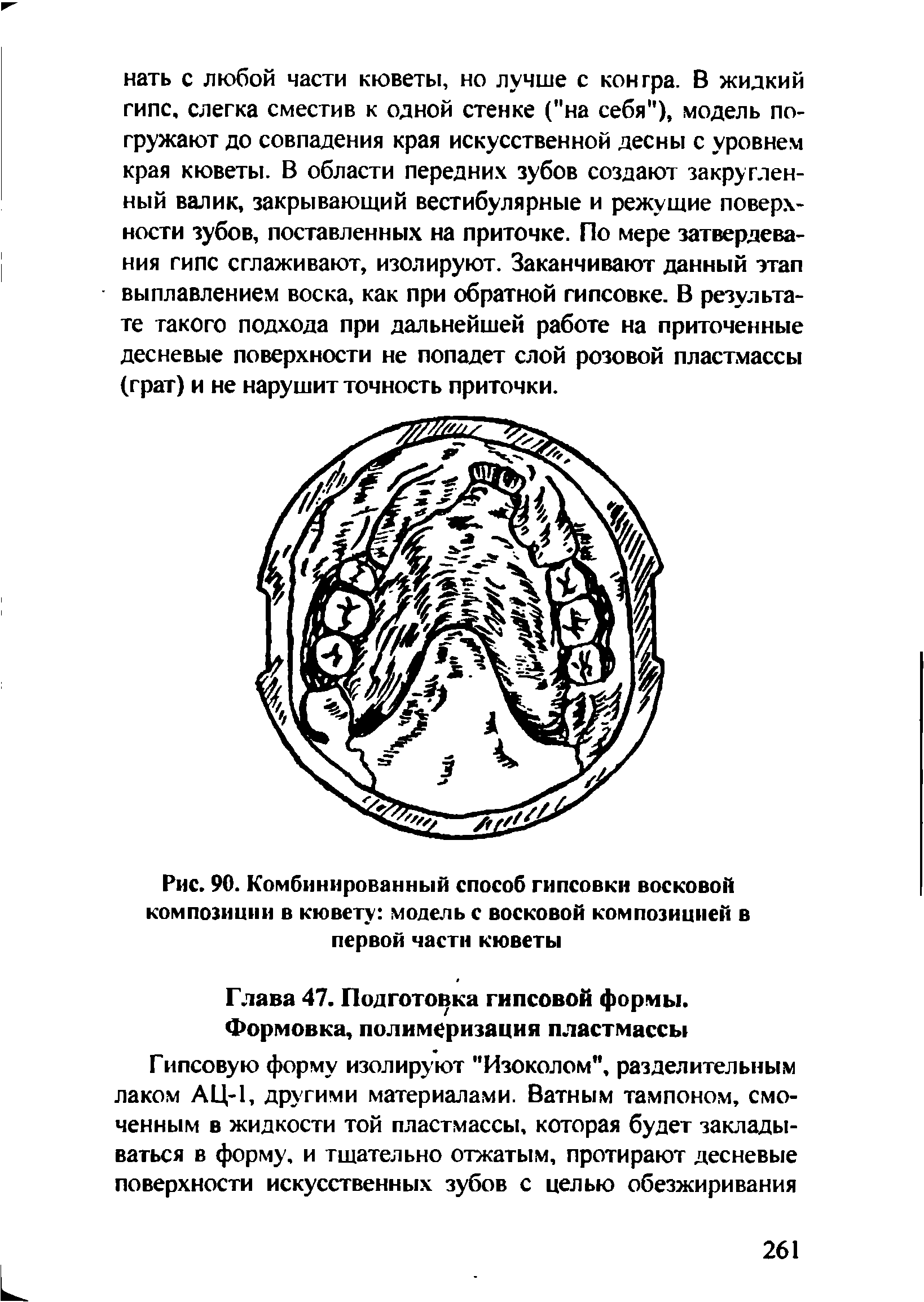 Рис. 90. Комбинированный способ гипсовки восковой композиции в кювету модель с восковой композицией в первой части кюветы...