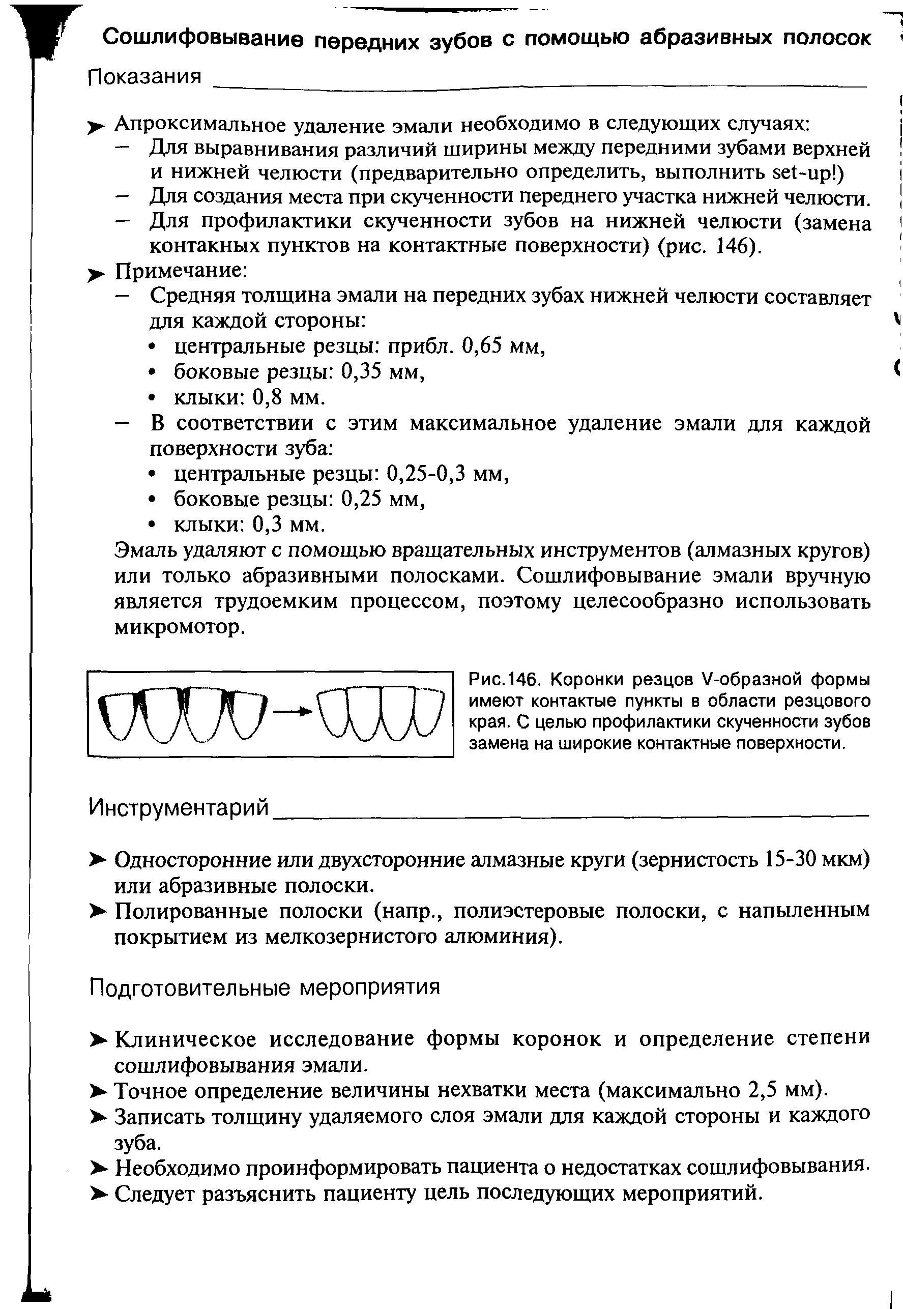 Рис. 146. Коронки резцов V-образной формы имеют контактые пункты в области резцового края. С целью профилактики скученности зубов замена на широкие контактные поверхности.