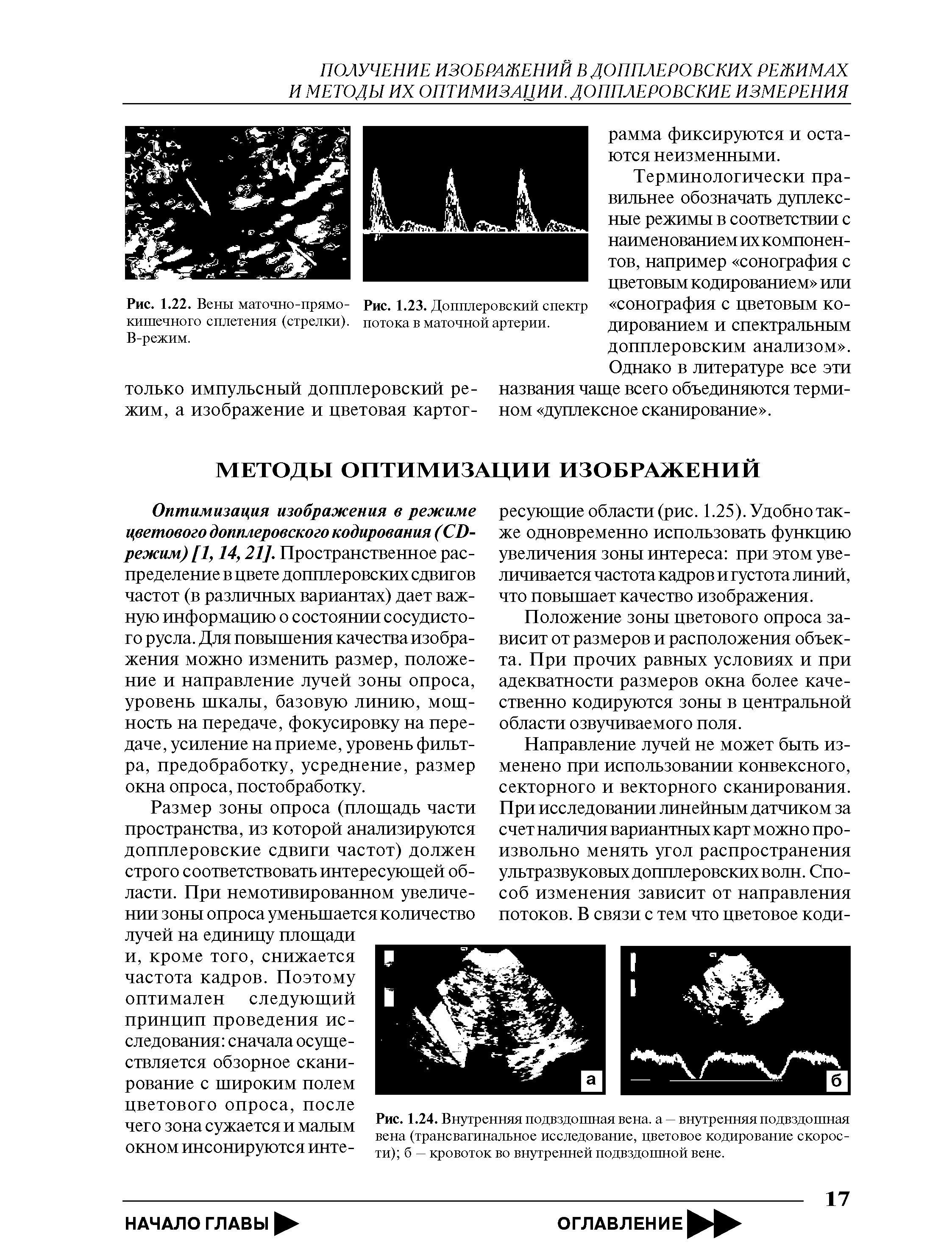 Рис. 1.24. Внутренняя подвздошная вена, а — внутренняя подвздошная вена (трансвагинальное исследование, цветовое кодирование скорости) б — кровоток во внутренней подвздошной вене.