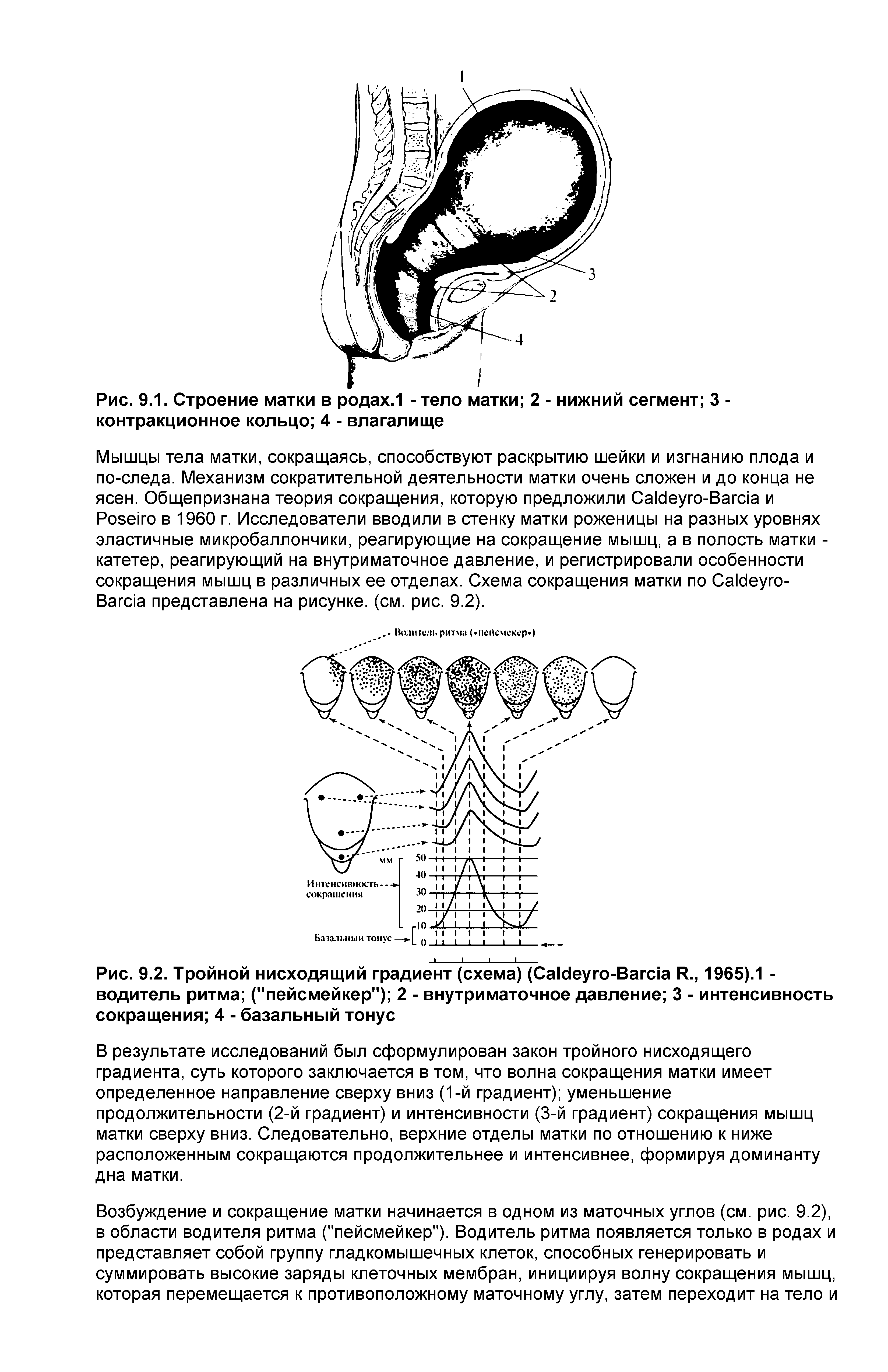 Рис. 9.1. Строение матки в родах. 1 - тело матки 2 - нижний сегмент 3 -контракционное кольцо 4 - влагалище...