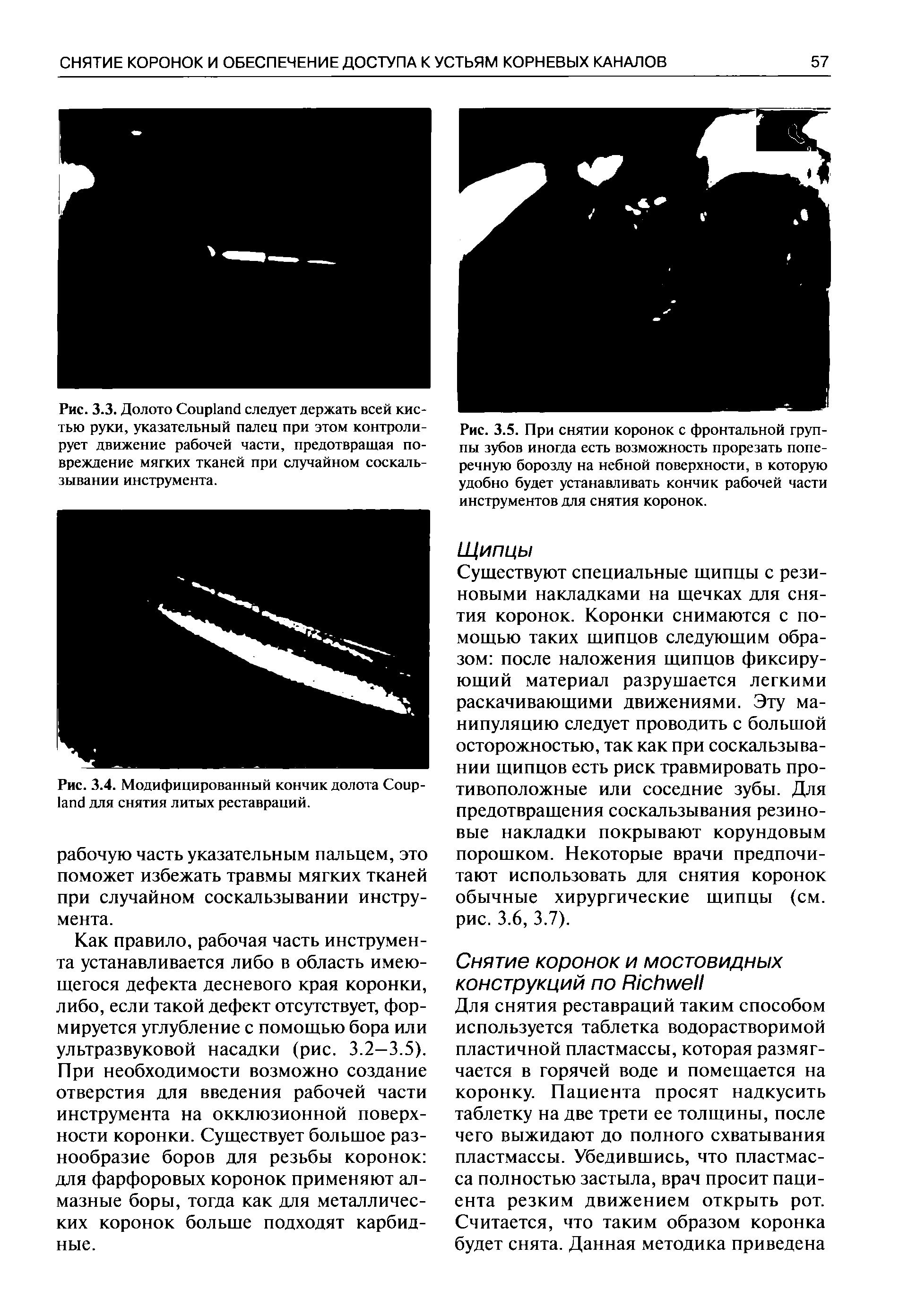 Рис. 3.4. Модифицированный кончик долота C для снятия литых реставраций.