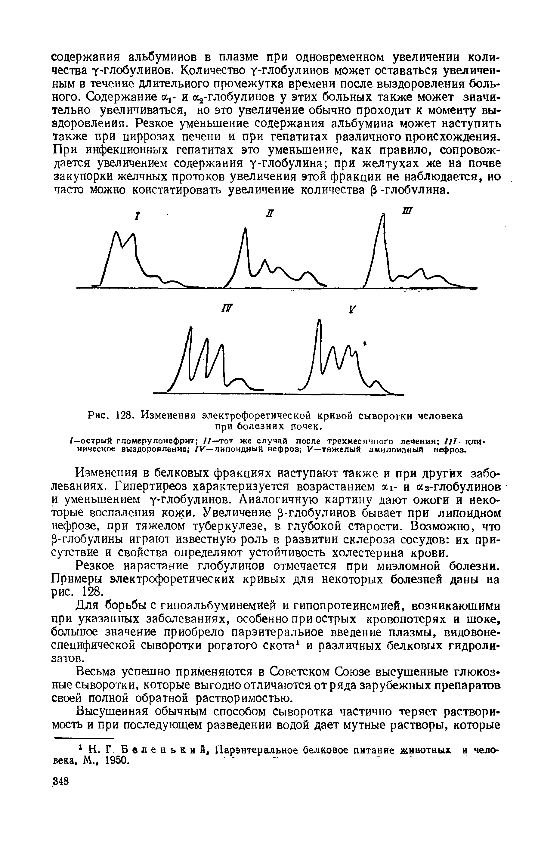 Рис. 128. Изменения электрофоретической кривой сыворотки человека при болезнях почек.