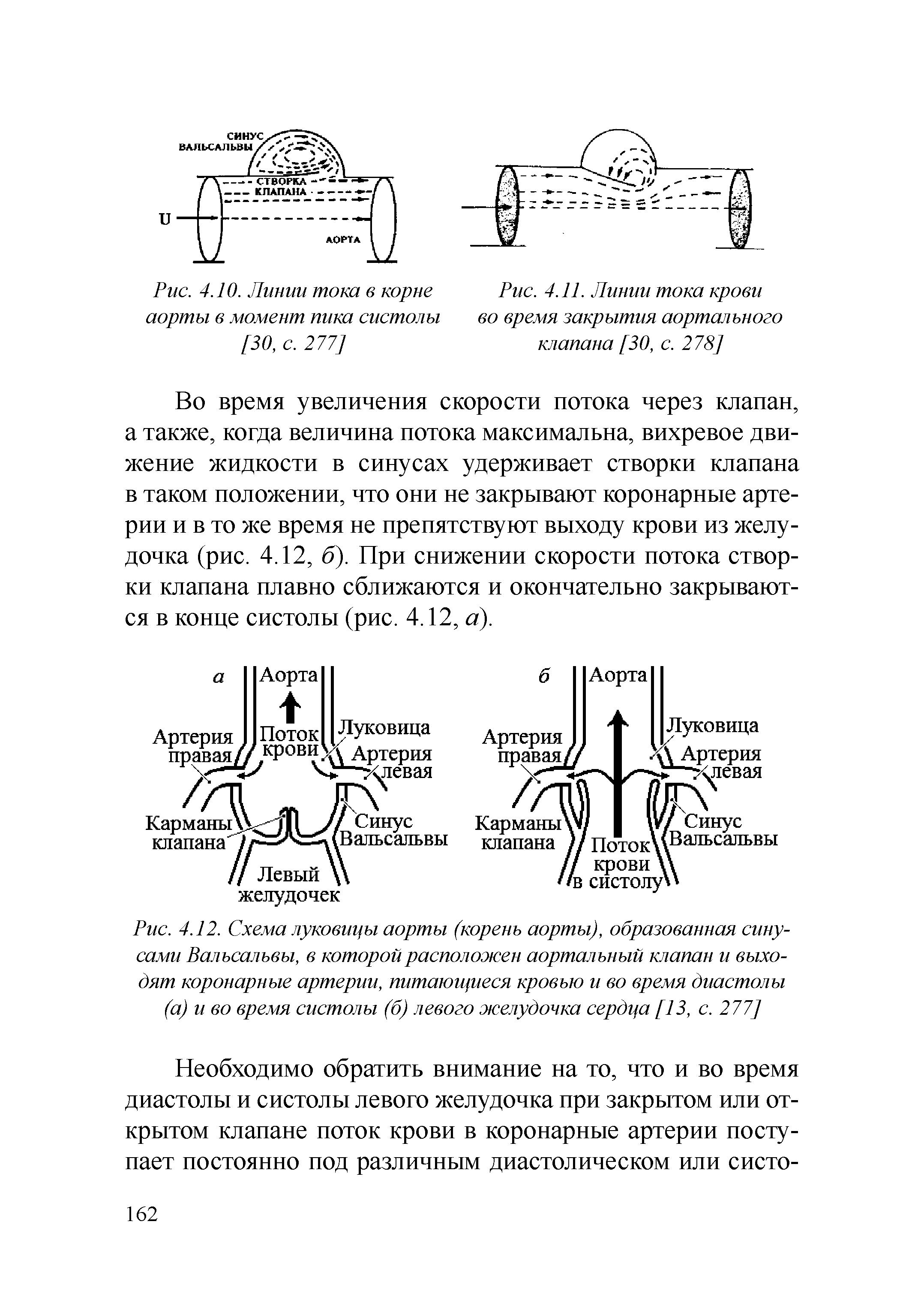 Рис. 4.12. Схема луковицы аорты (корень аорты), образованная синусами Вальсальвы, в которой расположен аортальный клапан и выходят коронарные артерии, питающиеся кровью и во время диастолы (а) и во время систолы (б) левого желудочка сердца [13, с. 277]...