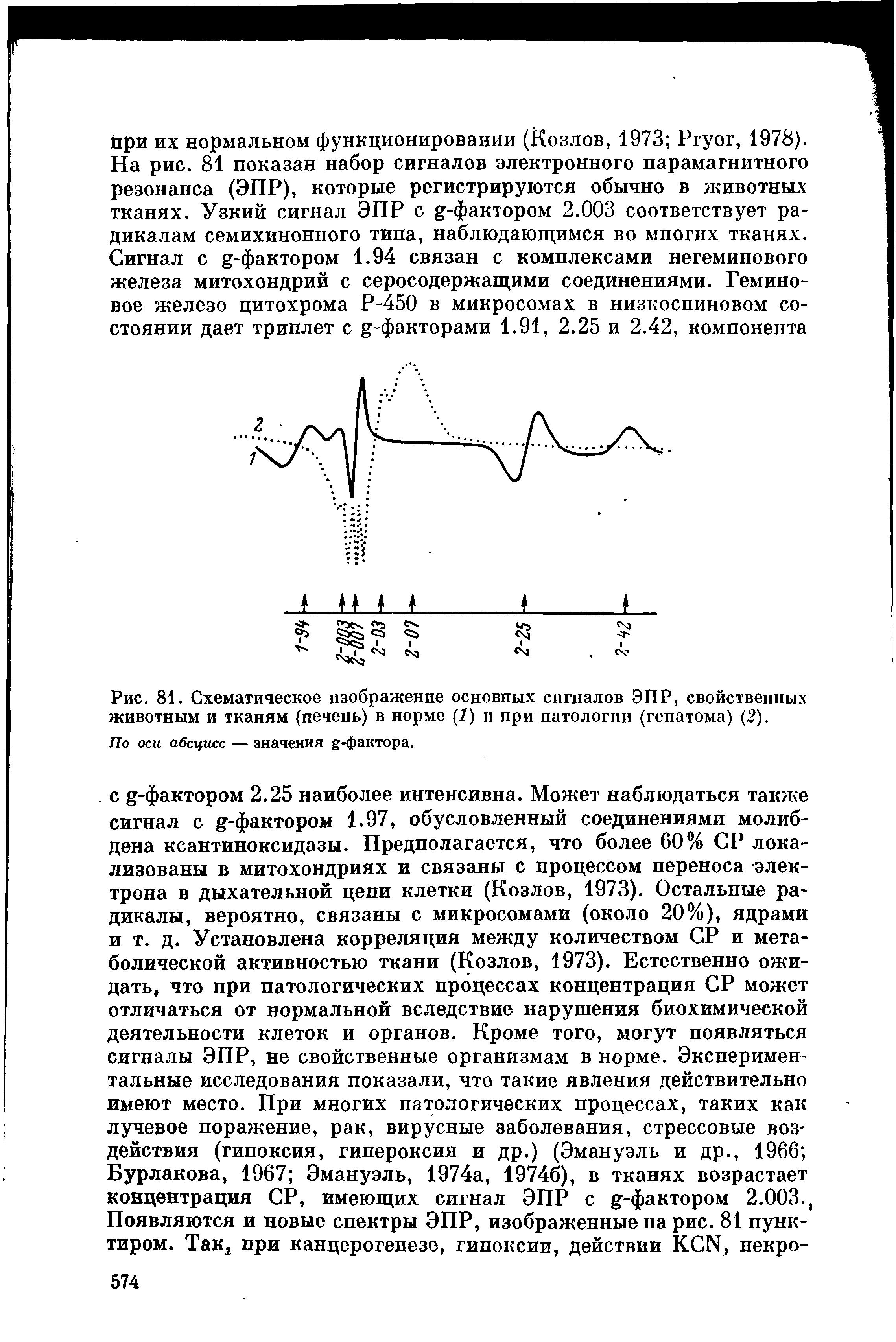 Рис. 81. Схематическое изображение основных сигналов ЭПР, свойственных животным и тканям (печень) в норме (7) и при патологии (гепатома) (2).