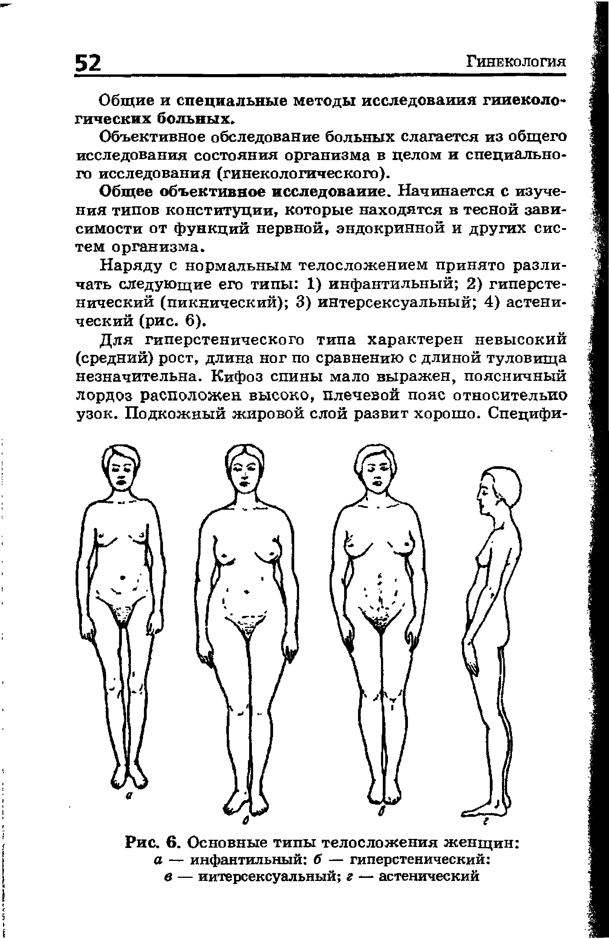 Рис. 6. Основные типы телосложения женщин а — инфантильный б — гиперстенический в — иитерсексуальный г — астенический...