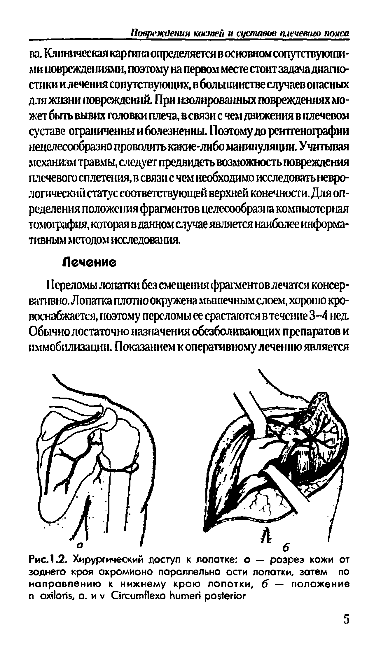 Рис. 1.2. Хирургический доступ к лопатке о — розрез кожи от зоднего кроя акромионо параллельно ости лопатки, затем по направлению к нижнему крою лопотки, б — положение л , о. и C ...