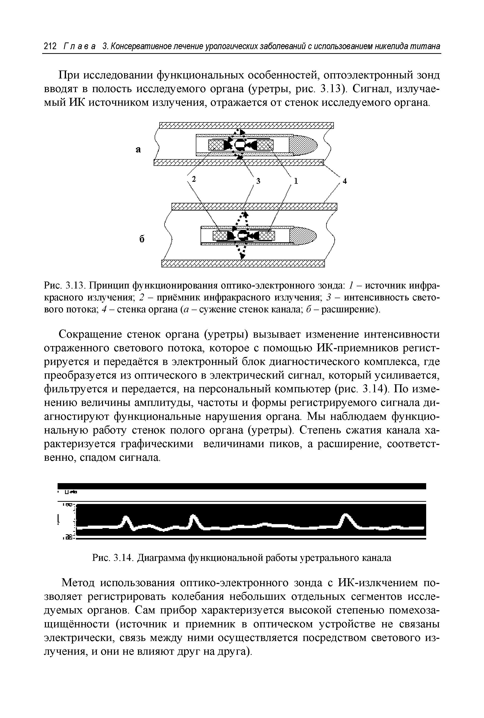 Рис. 3.13. Принцип функционирования оптико-электронного зонда 1 - источник инфракрасного излучения 2 - приёмник инфракрасного излучения 3 - интенсивность светового потока 4 - стенка органа (а - сужение стенок канала б - расширение).