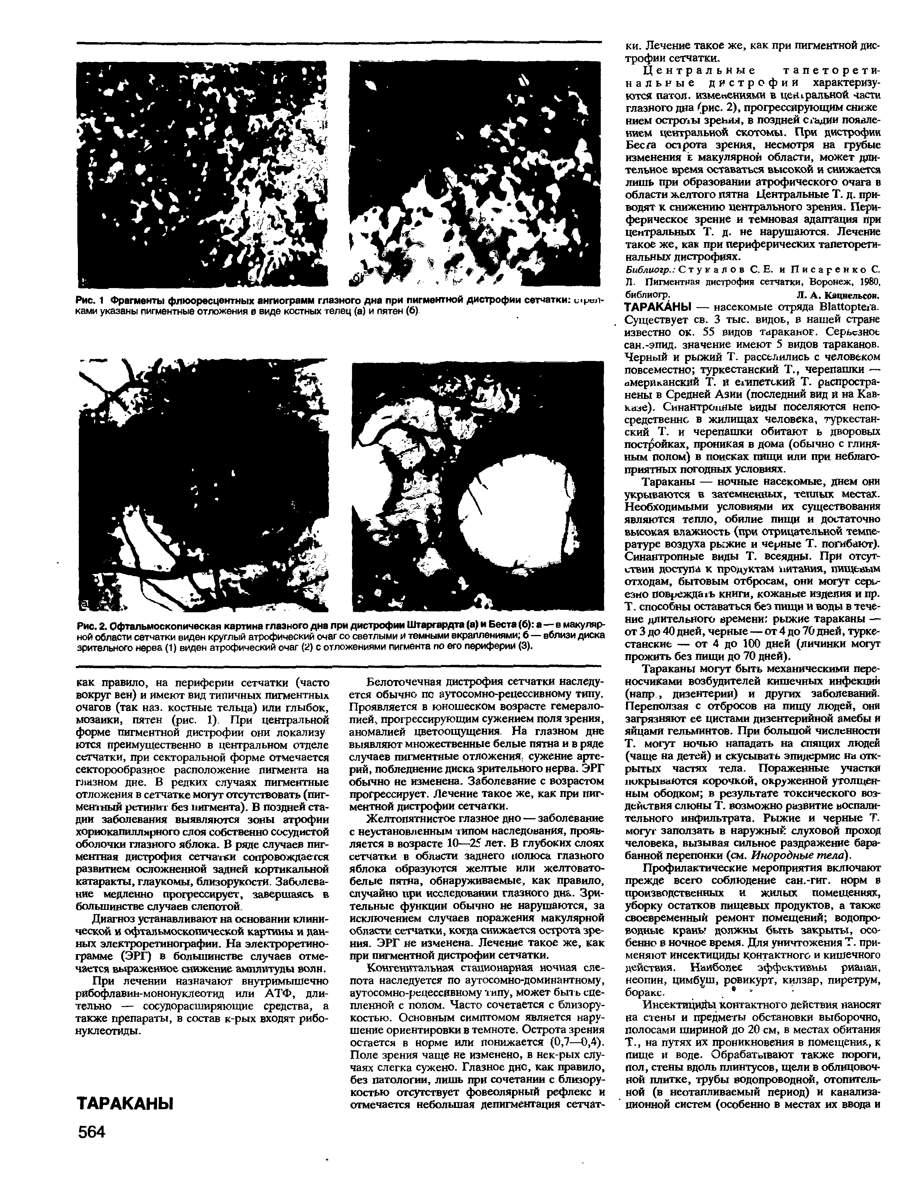 Рис. 2. Офтальмоскопическая картина глазного дна при дистрофии Штаргардта (а) и Беста (б) а—в макулярной области сетчатки виден круглый атрофический очаг со светлыми и темными вкраплениями б— вблизи диска зрительного нерва (1) виден атрофический очаг (2) с отложениями пигмента по его периферии (3).