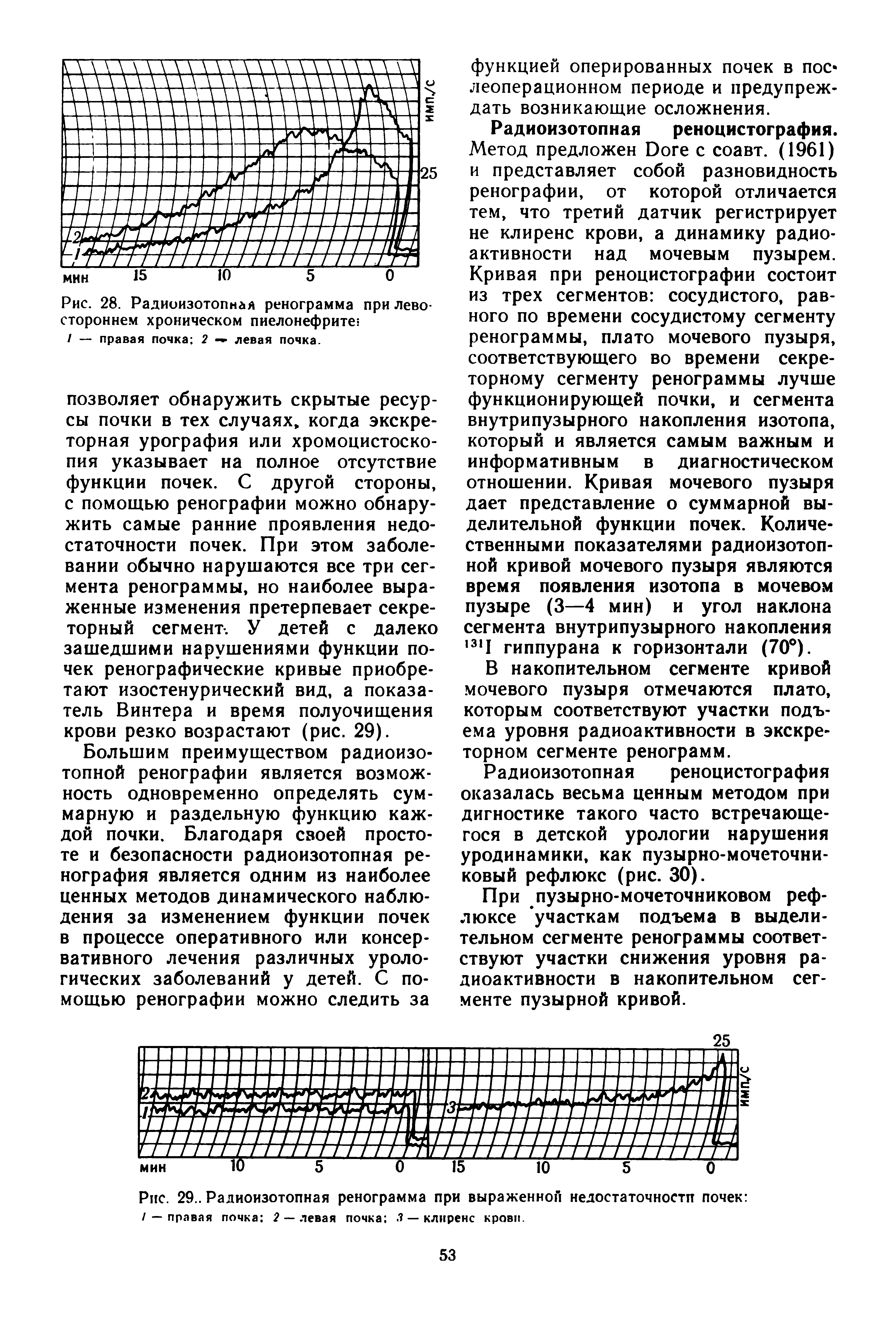 Рис. 29.. Радиоизотопная ренограмма при выраженной недостаточностп почек / — правая почка 2 — левая почка —клиренс крови.