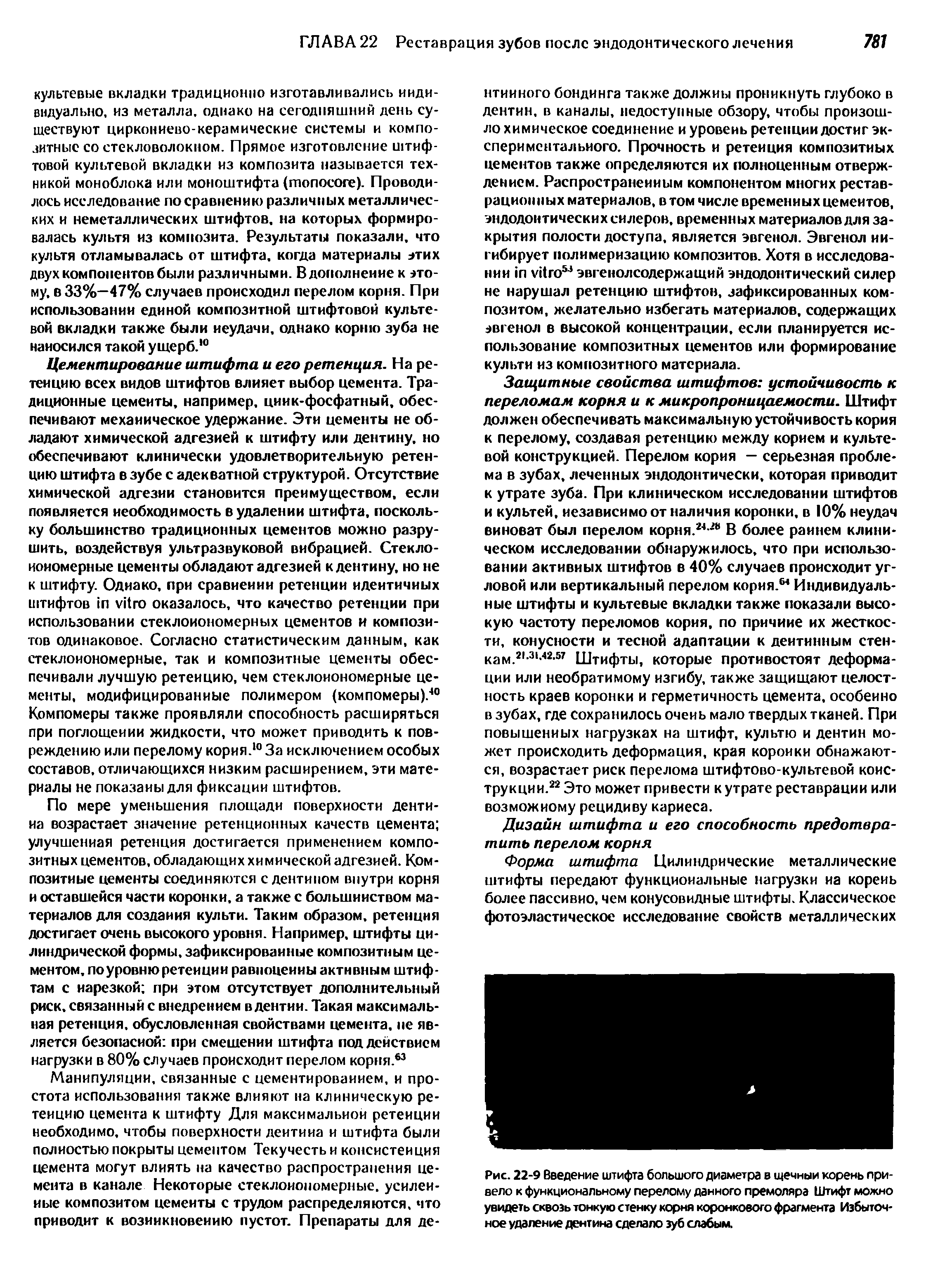 Рис. 22-9 Введение штифта большого диаметра в щечный корень привело к функциональному перелому данного премоляра Штифт можно увидеть сквозь тонкую стенку корня коронкового фрагмента Избыточное удаление дентина сделало зуб слабым.