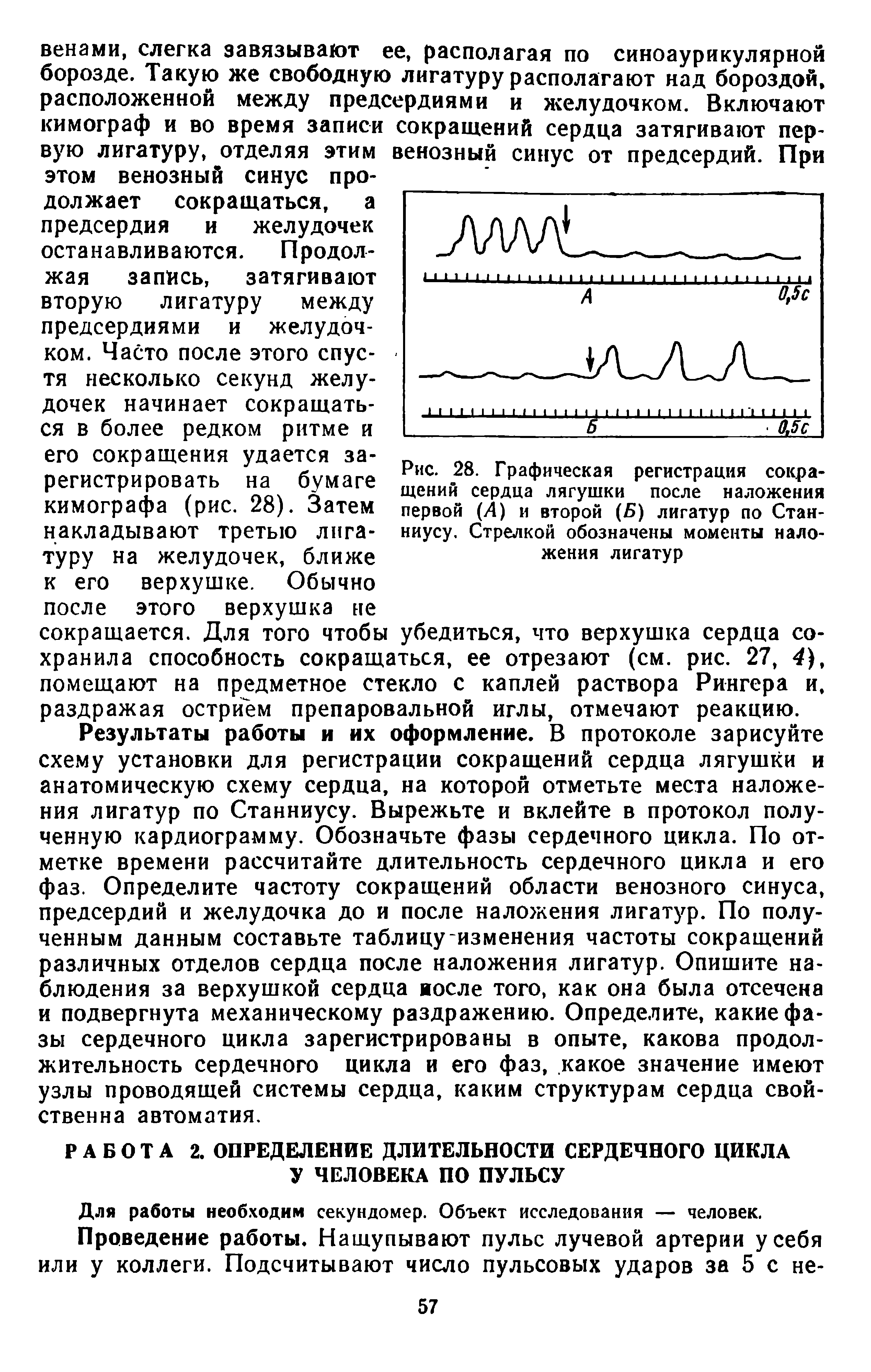 Рис. 28. Графическая регистрация сокращений сердца лягушки после наложения первой (Л) и второй (Б) лигатур по Стан-ниусу. Стрелкой обозначены моменты наложения лигатур...