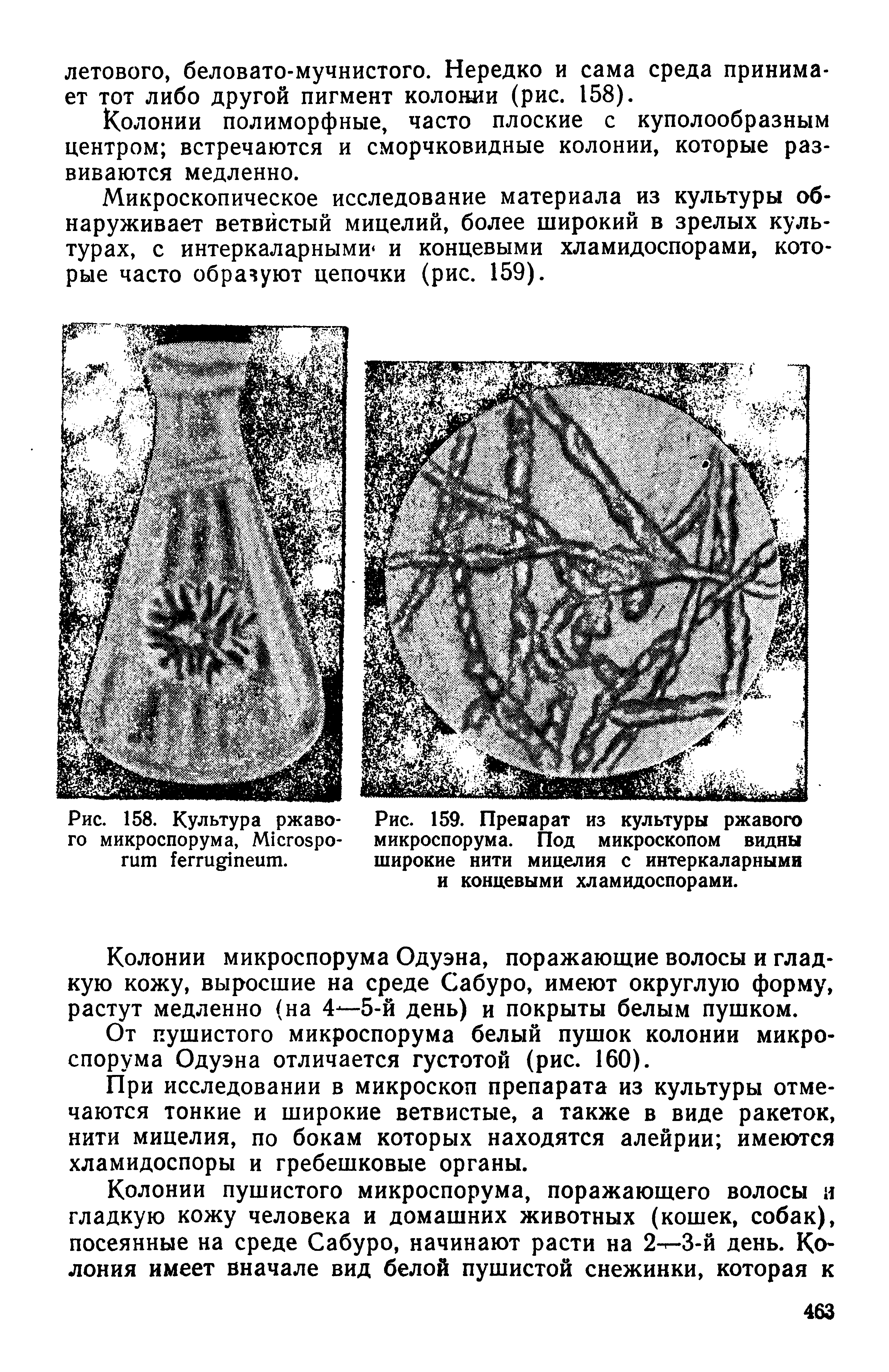 Рис. 159. Препарат из культуры ржавого микроспорума. Под микроскопом видны широкие нити мицелия с интеркаларными и концевыми хламидоспорами.