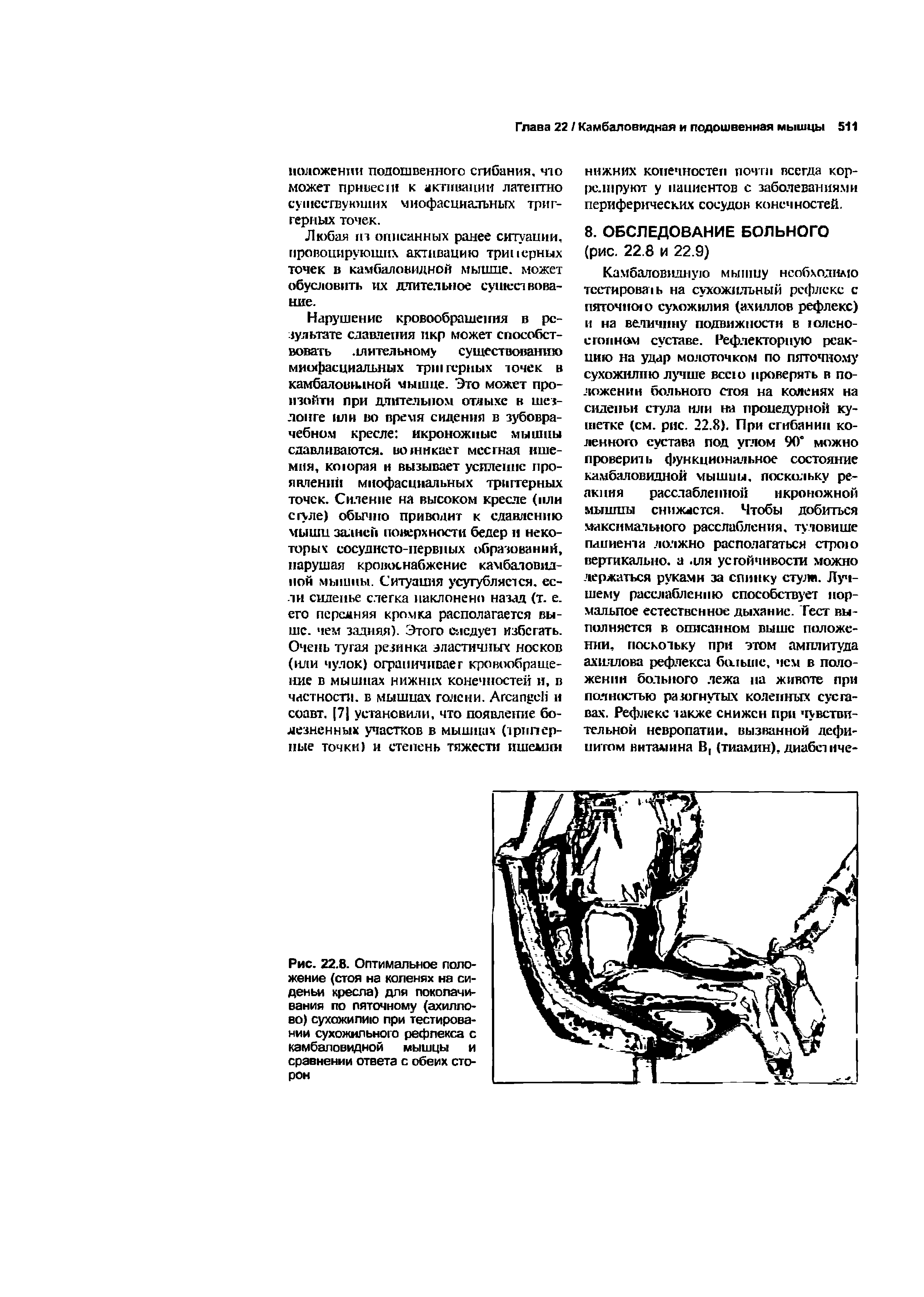 Рис. 22.8. Оптимальное положение (стоя на коленях на си-деньи кресла) для поколачивания по пяточному (ахиллово) сухожилию при тестировании сухожильного рефлекса с камбаловидной мышцы и сравнении ответа с обеих сторон...