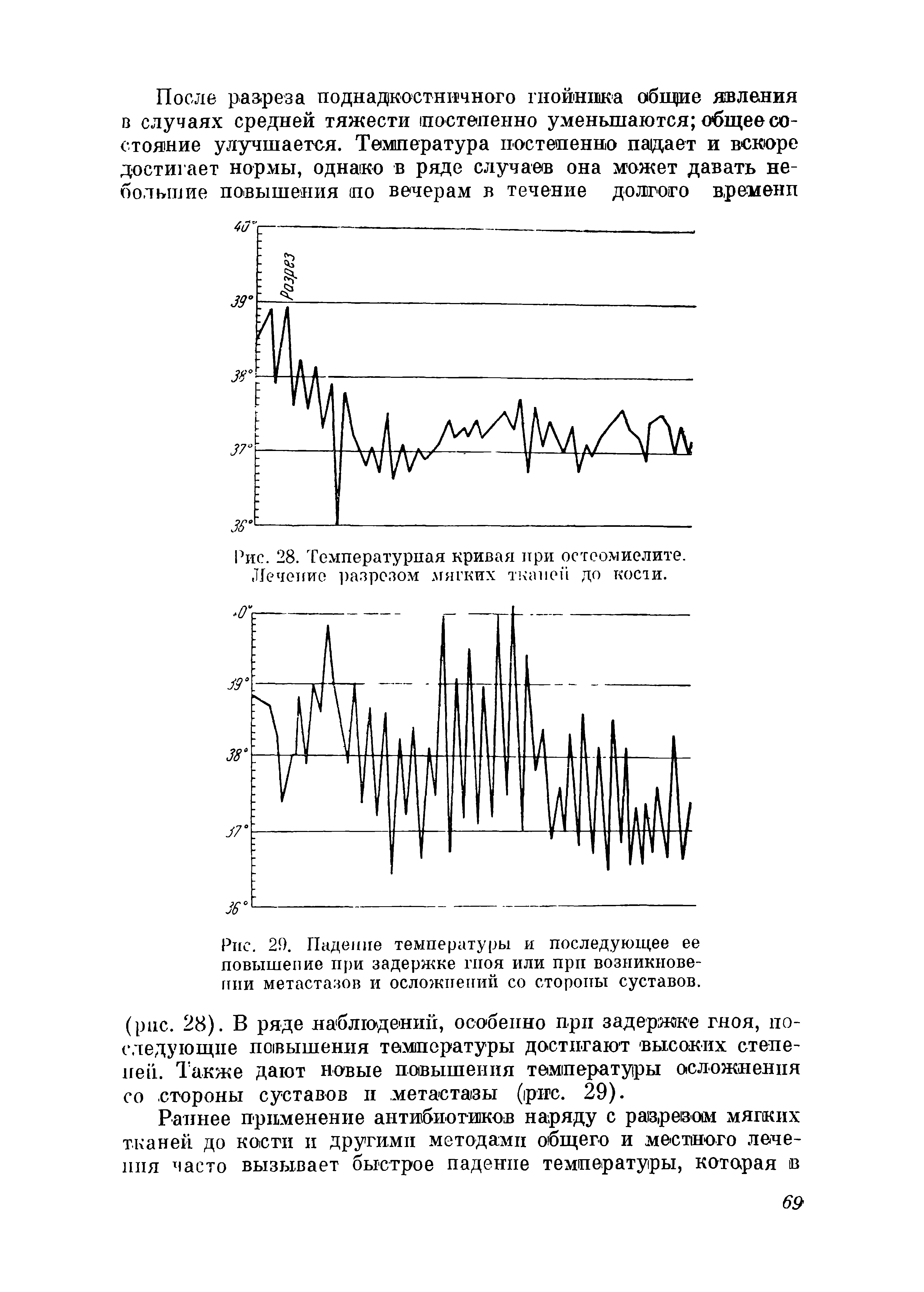 Рис. 28. Температурная кривая при остеомиелите. Лечение разрезом мягких тканей до кости.
