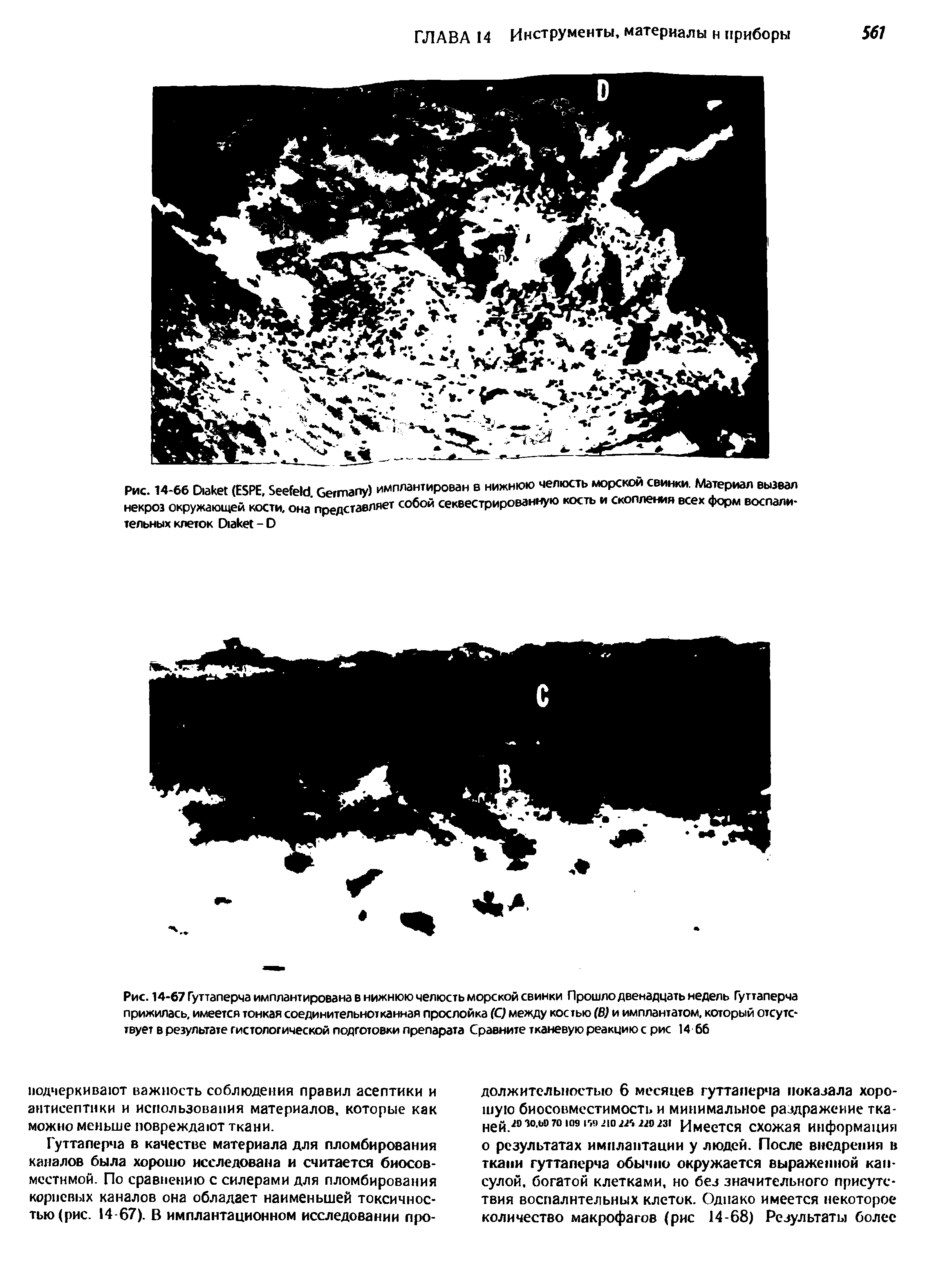 Рис. 14-67 Гуттаперча имплантирована в нижнюю челюсть морской свинки Прошло двенадцать недель Гуттаперча прижилась, имеется тонкая соединительнотканная прослойка (С) между костью (В) и имплантатом, который отсутствует в результате гистологической подготовки препарата Сравните тканевую реакцию с рис 14 66...