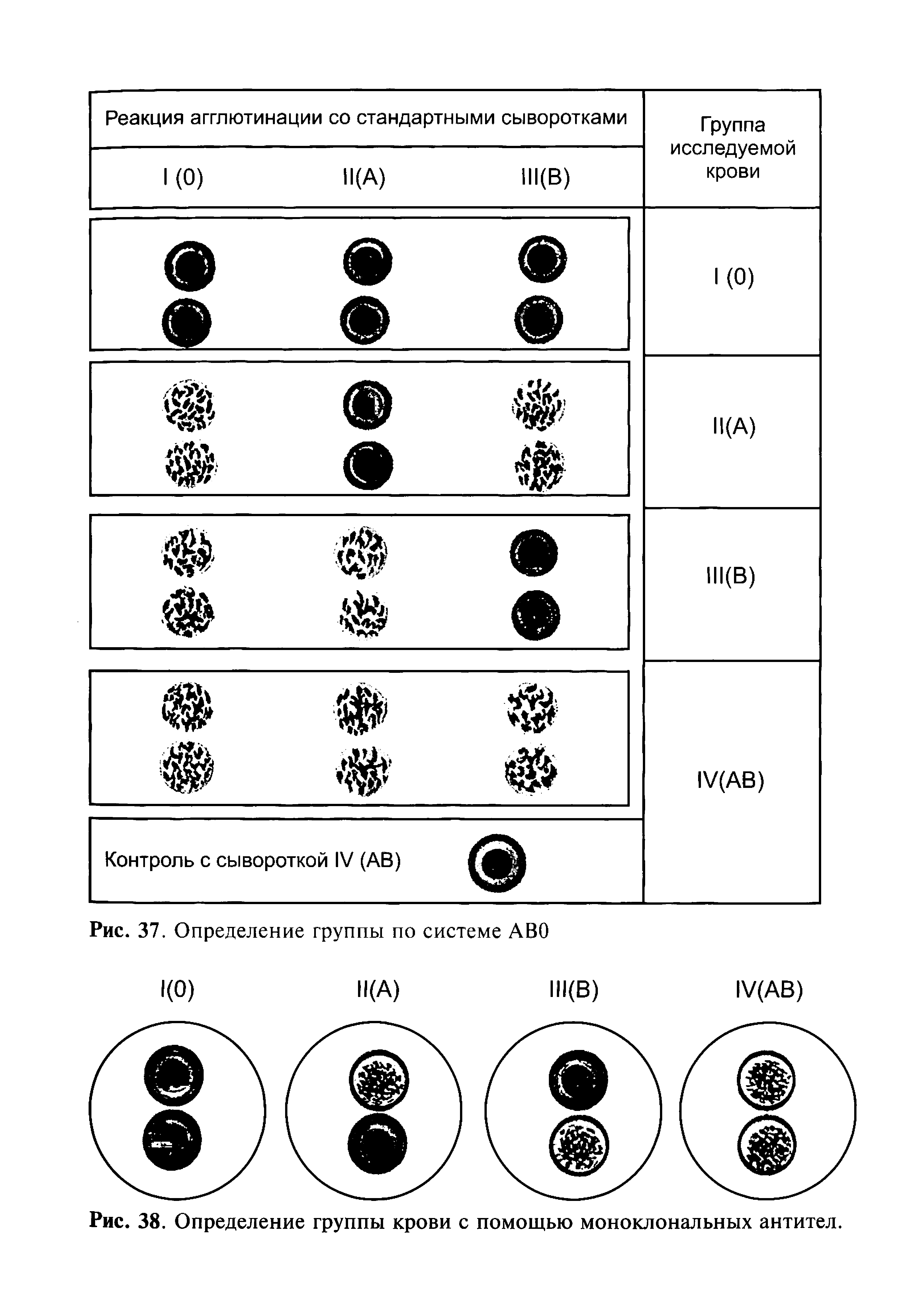 Рис. 38. Определение группы крови с помощью моноклональных антител.