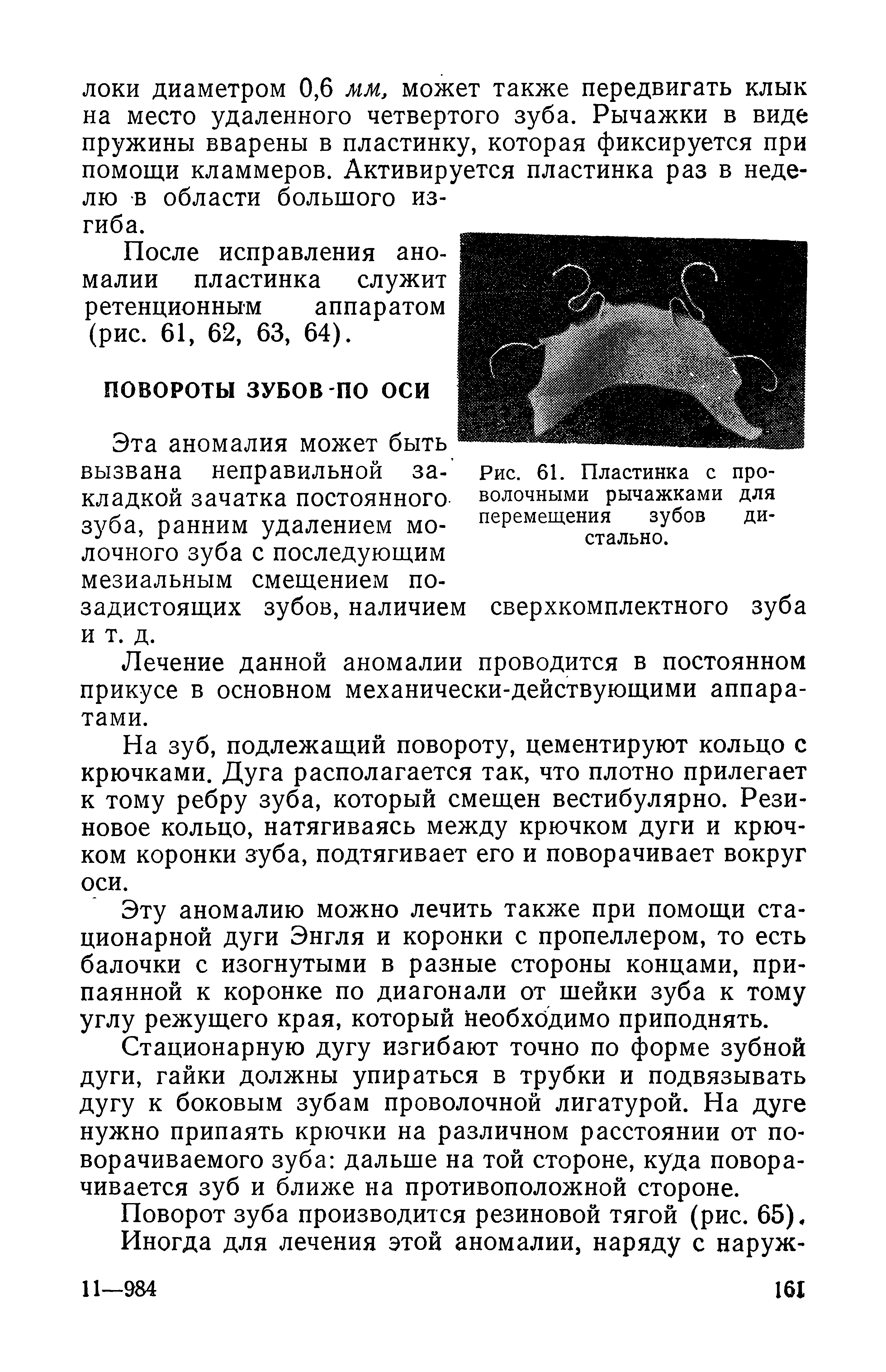 Рис. 61. Пластинка с проволочными рычажками для перемещения зубов дистально.